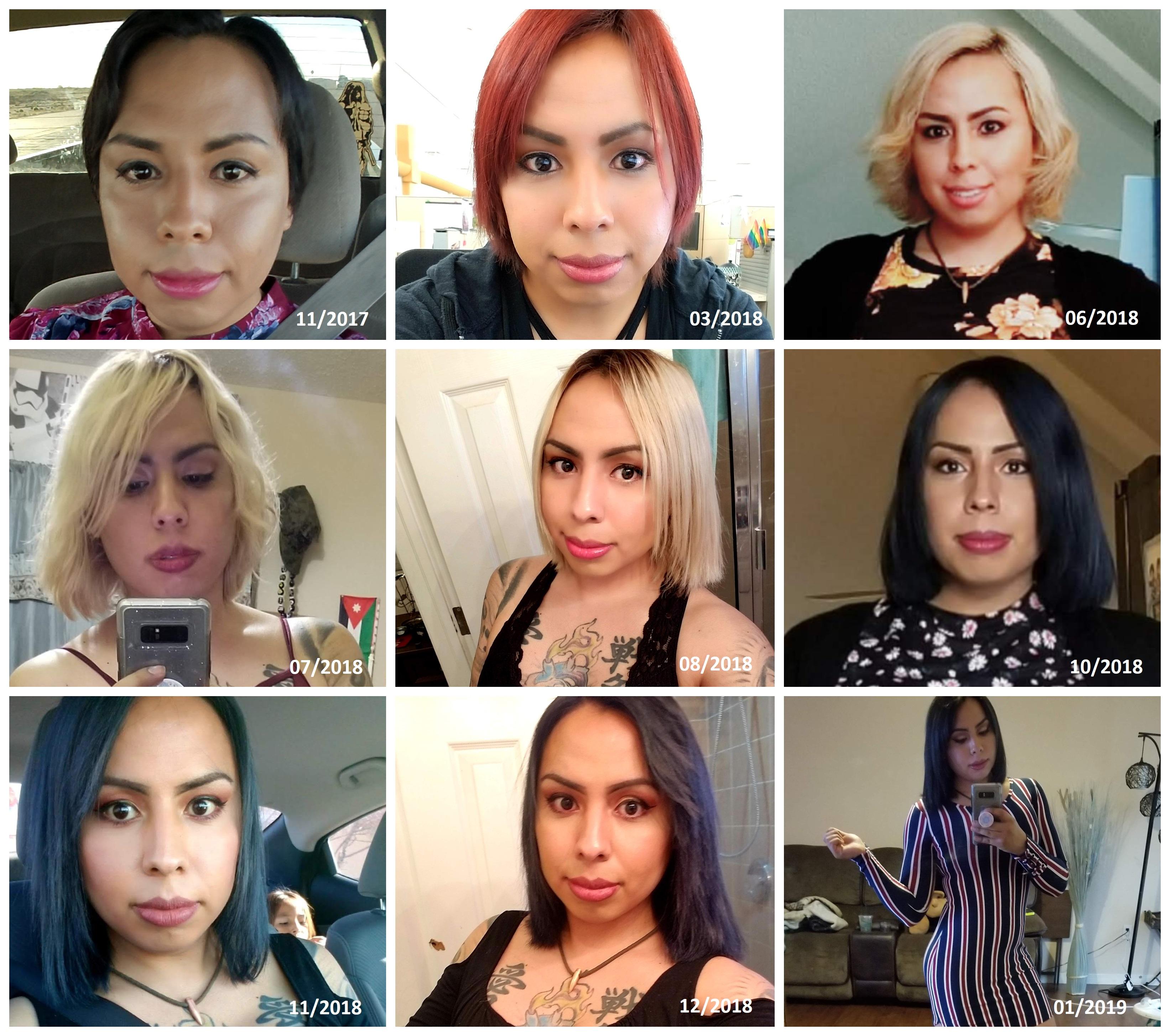 31yo MtF Face (and hair) Timeline 14 months on Estrogen that