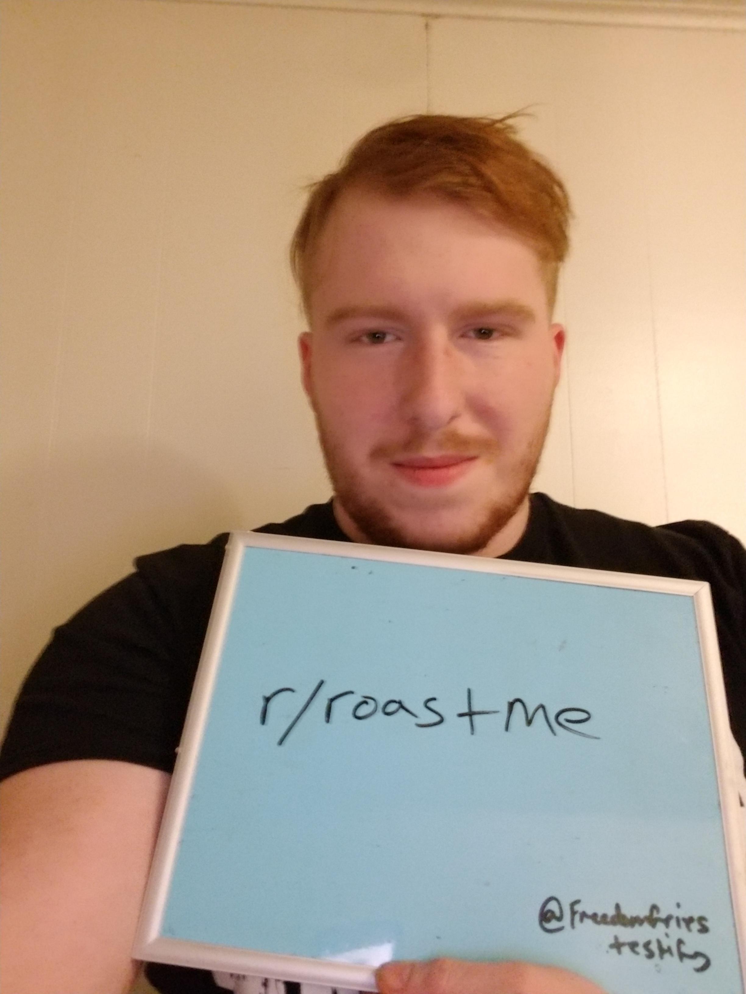 Hairline Roast Me r/RoastMe you roasted me yesterday so hard about my hairline, so i decided