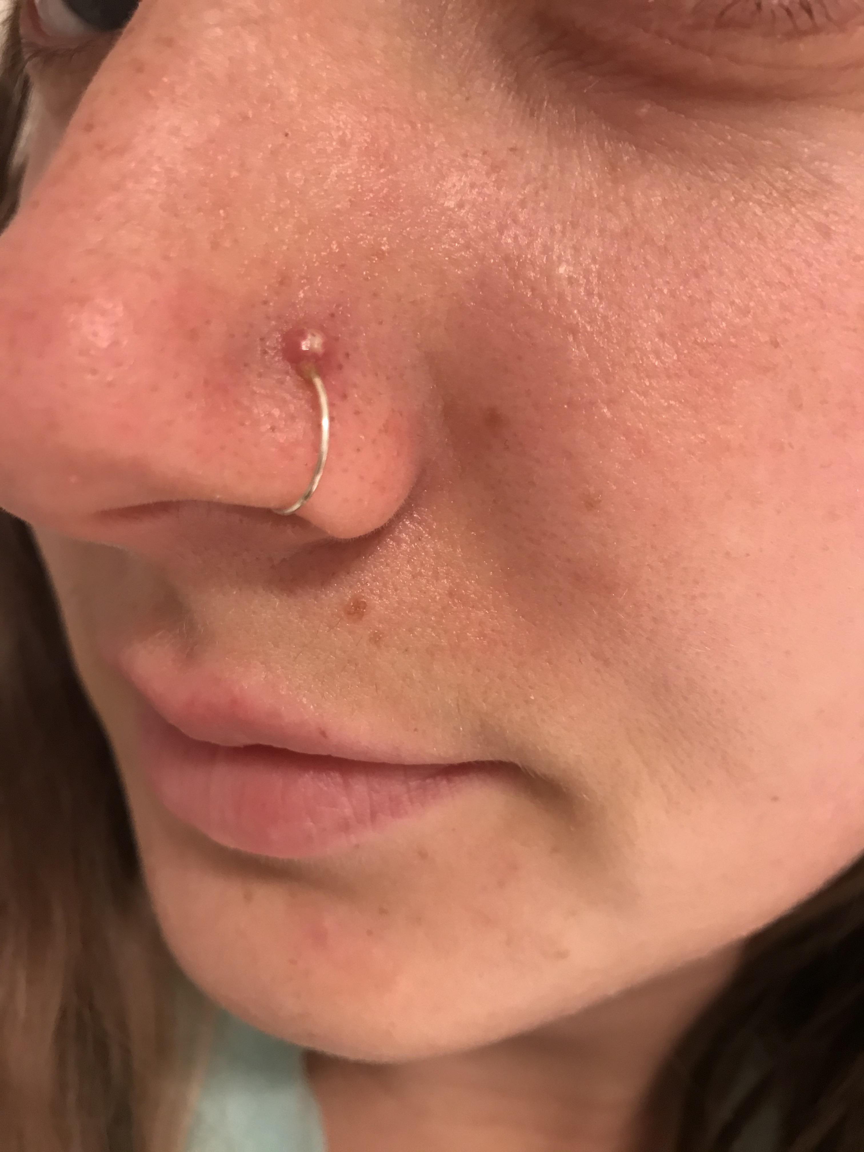 Angry nose piercing! Been pierced for two months, the