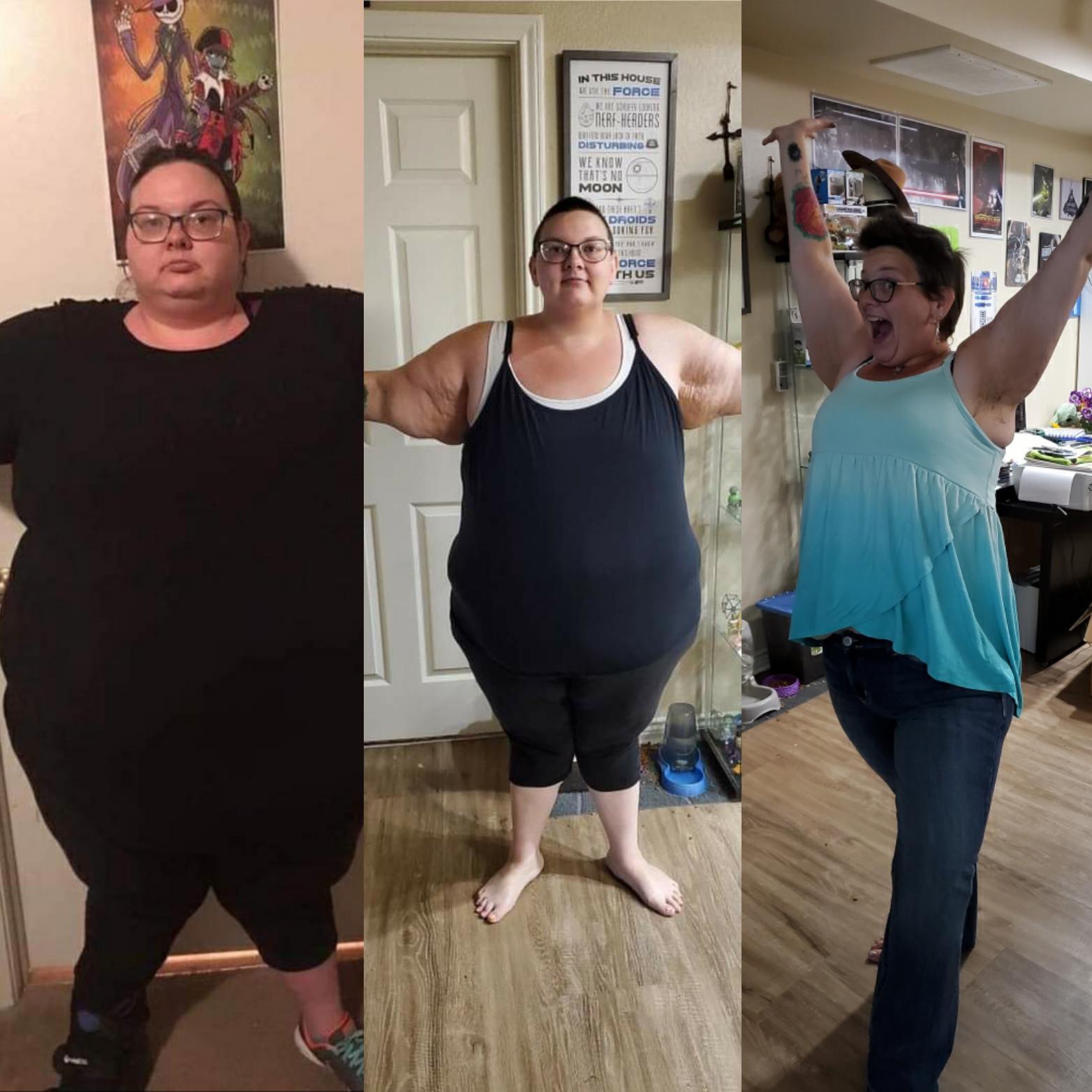 Down 260 pounds and Counting! r/SuperMorbidlyObese