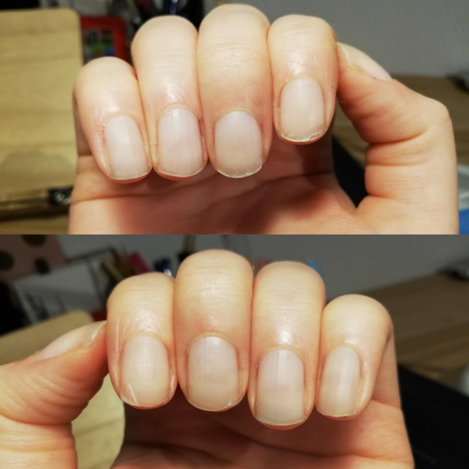 Does anyone know how I can make my nails stop peeling? They only ever