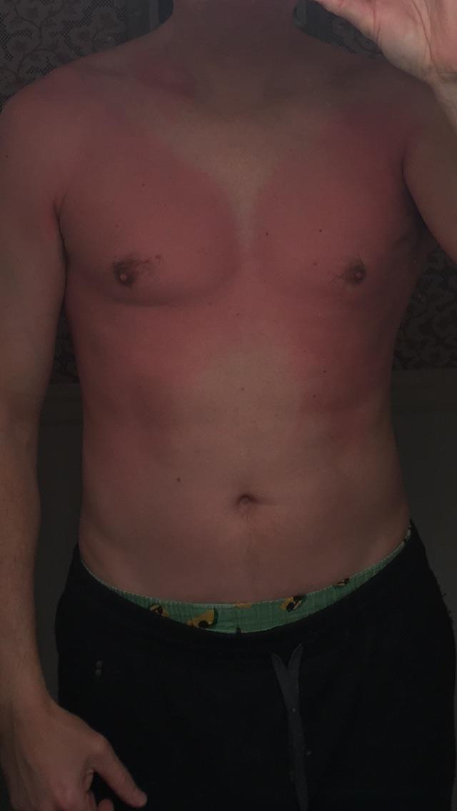 Why does my chest turn red after stretching my shoulders? r/AskDoctorJo