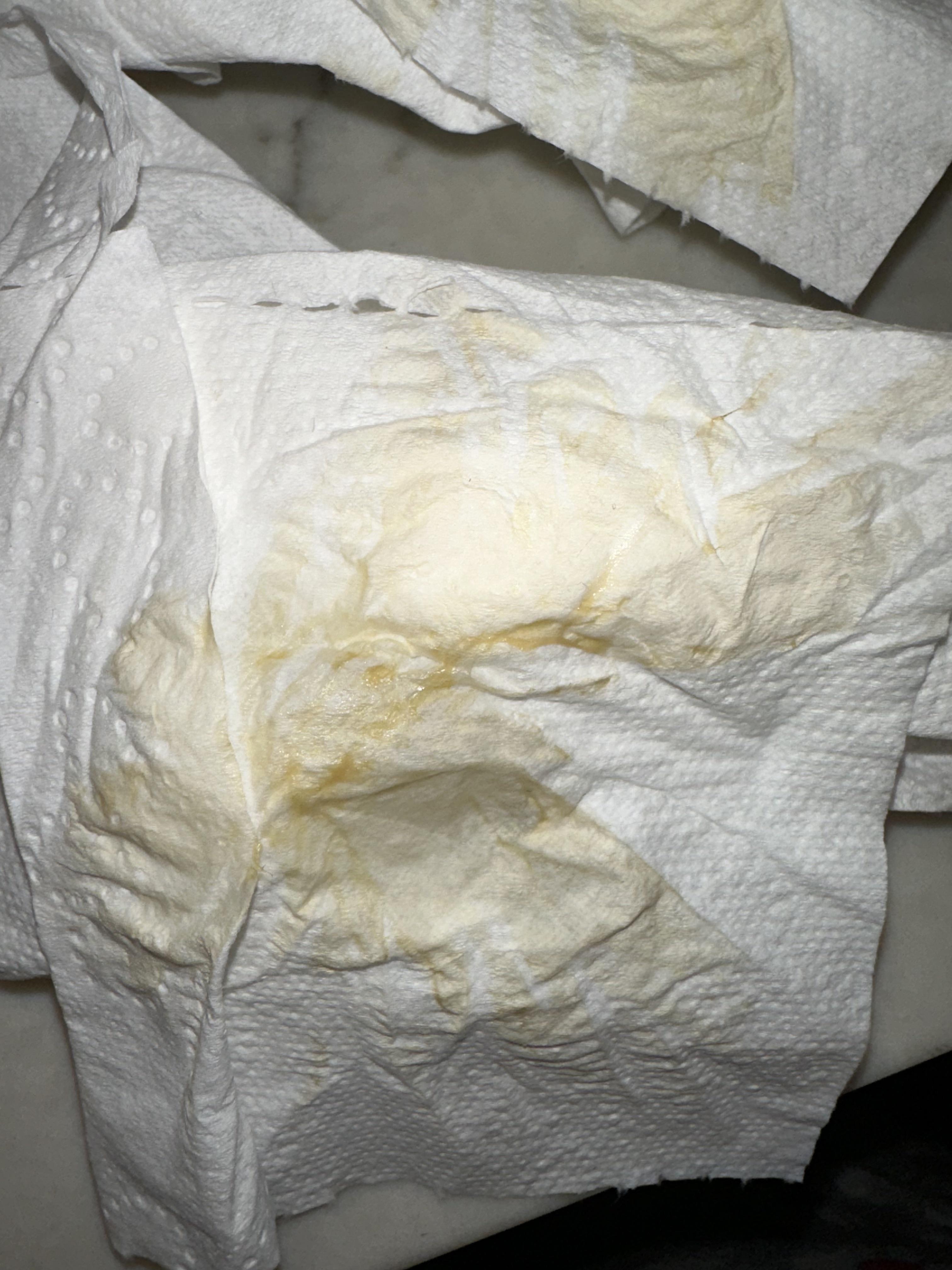 Yellowish discharge 8 weeks pregnant r/pregnancyproblems