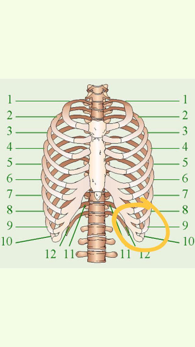 Anyone have lumps on this parts of the ribs?? r/costochondritis