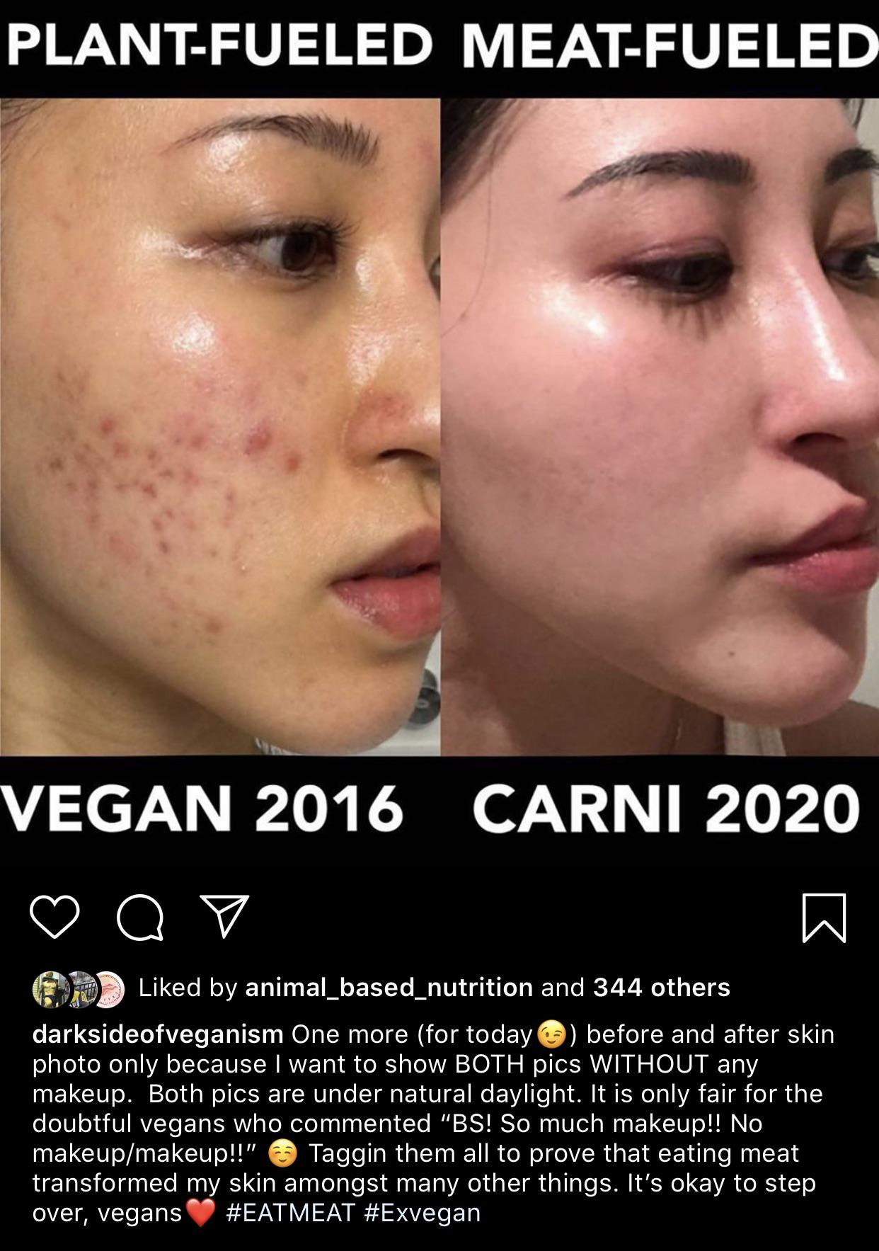 A vegan to carnivore story without any makeup r/exvegans