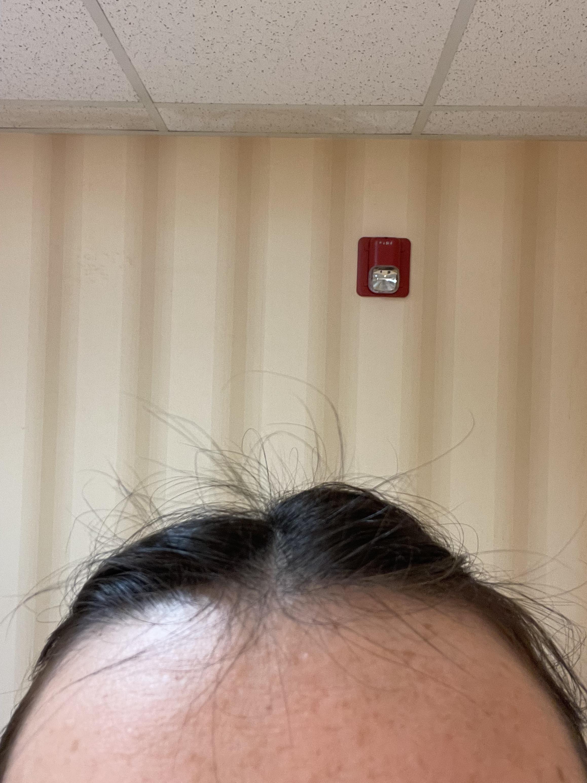 This breakage is insane. No heat, no coloring, silk pillowcase