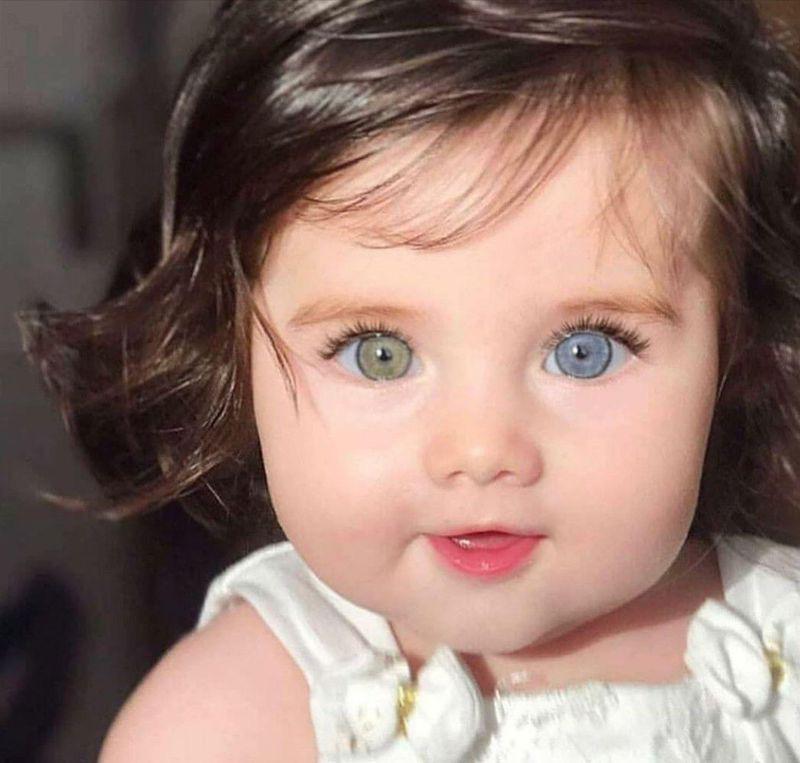 Heterochromia is a difference in coloration, usually of the iris but