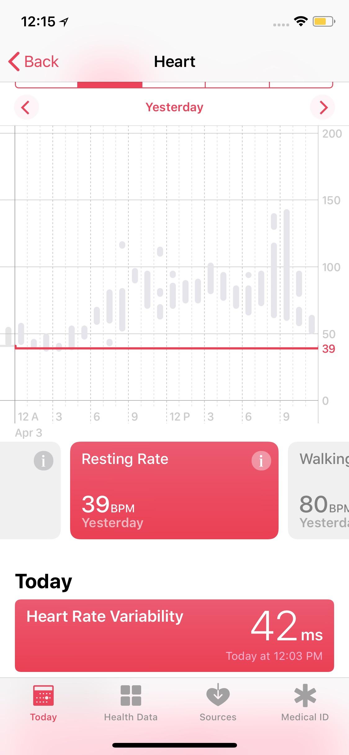 My resting heart rate is 39 bpm and I’m not an elite athlete.. should I