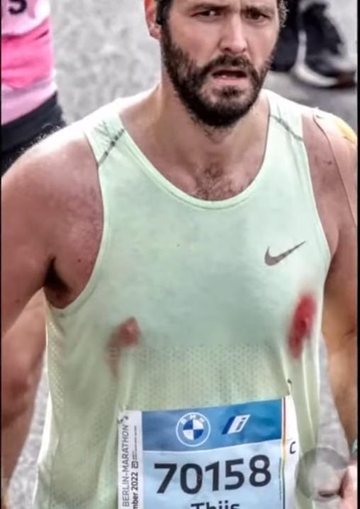 Bleeding chafed nipples during a marathon. r/oddlyterrifying