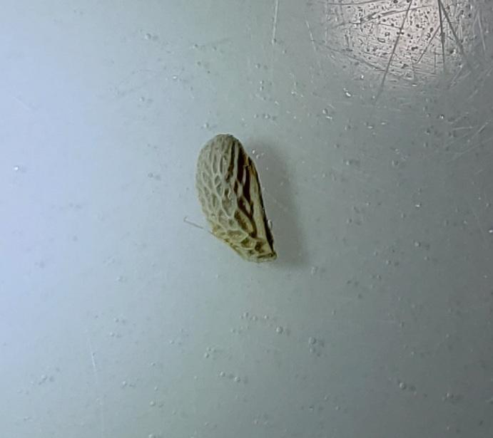 Anyone seen a kidney stone with this texture? It's the size of a sesame seed with the texture of