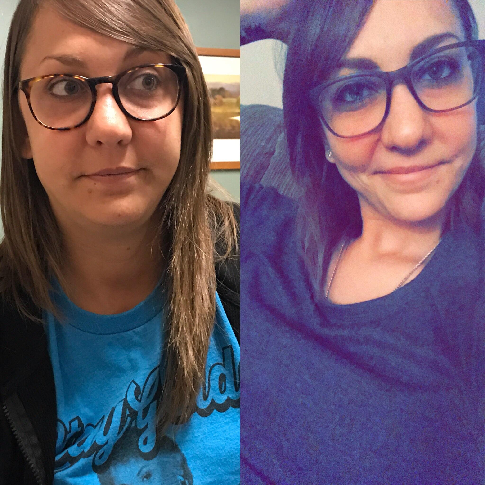 Prednisone Before & After!! I didn't get to participate in the fun when