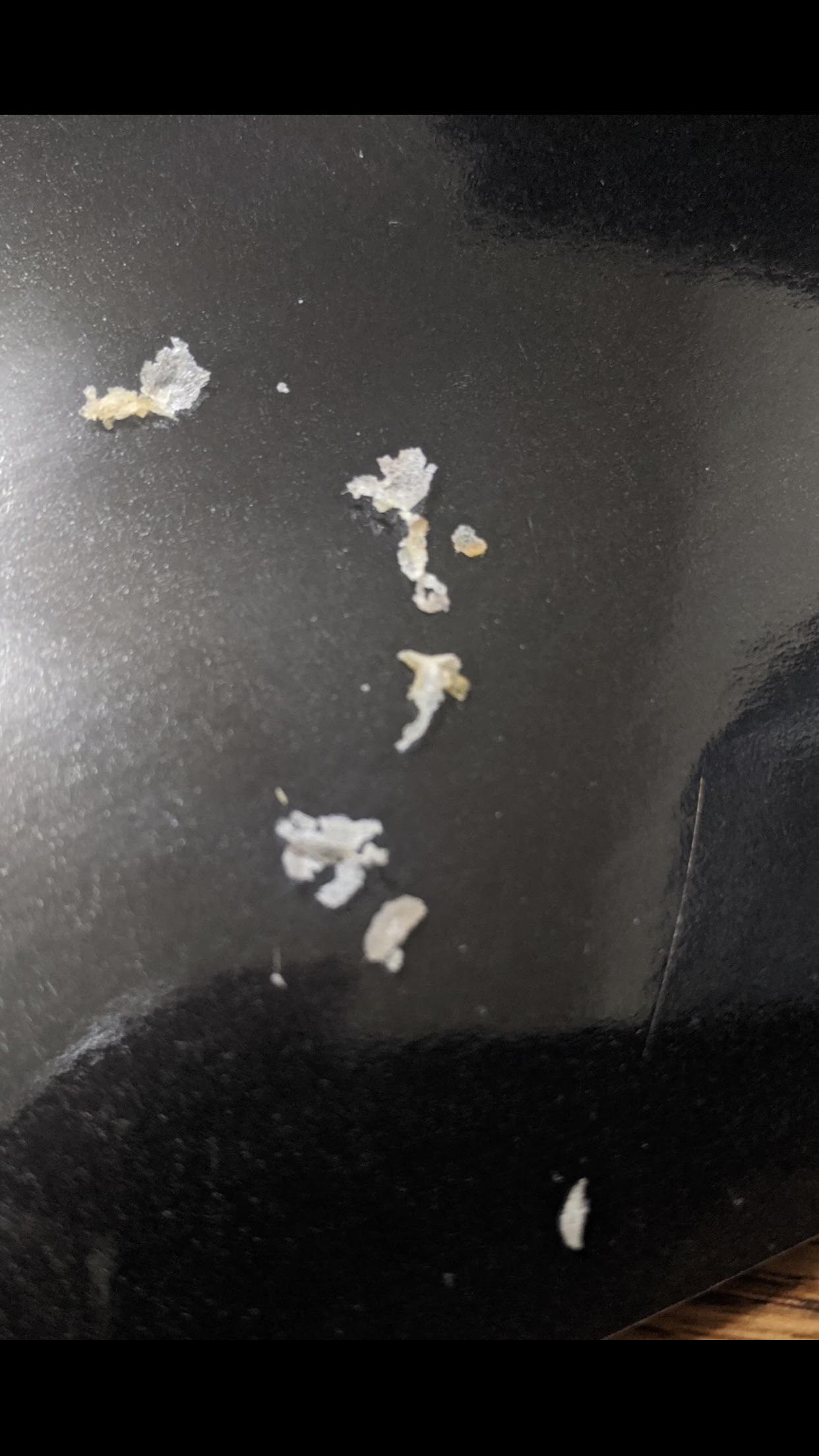 What is this? Only comes out of my left ear, can’t tell if it’s skin or