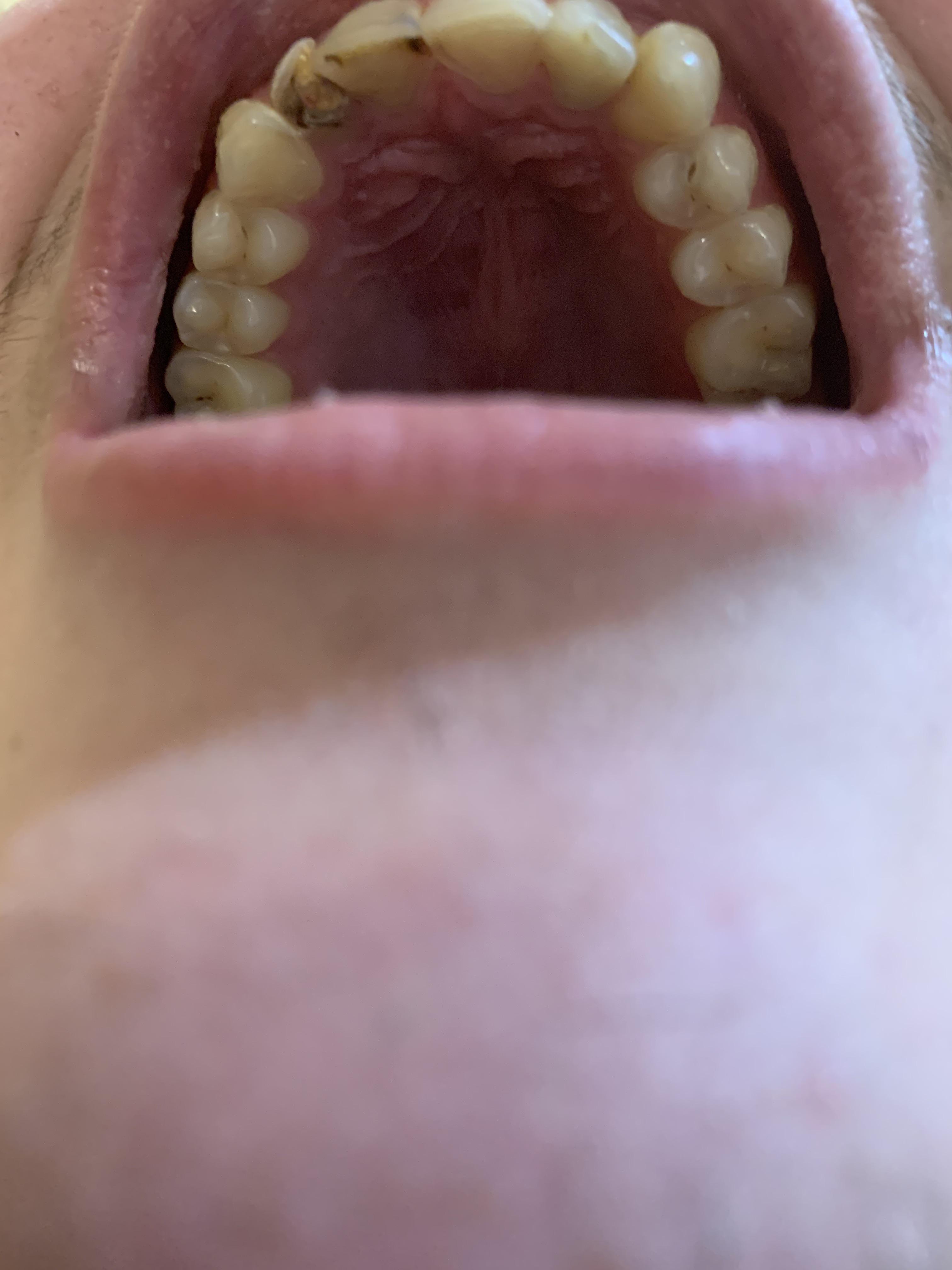 What are these spots? Teethcare