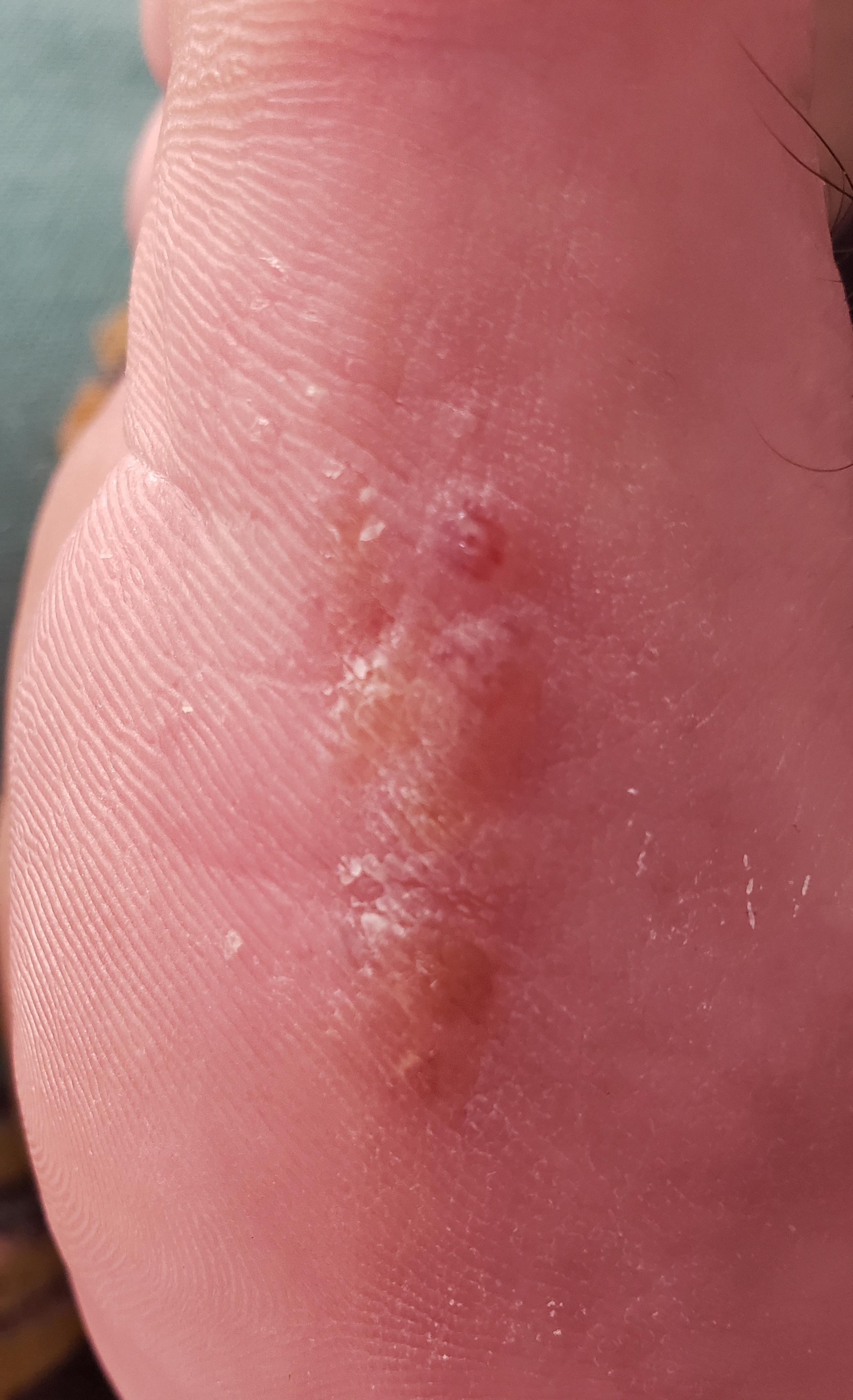 Reddit Dive into anything