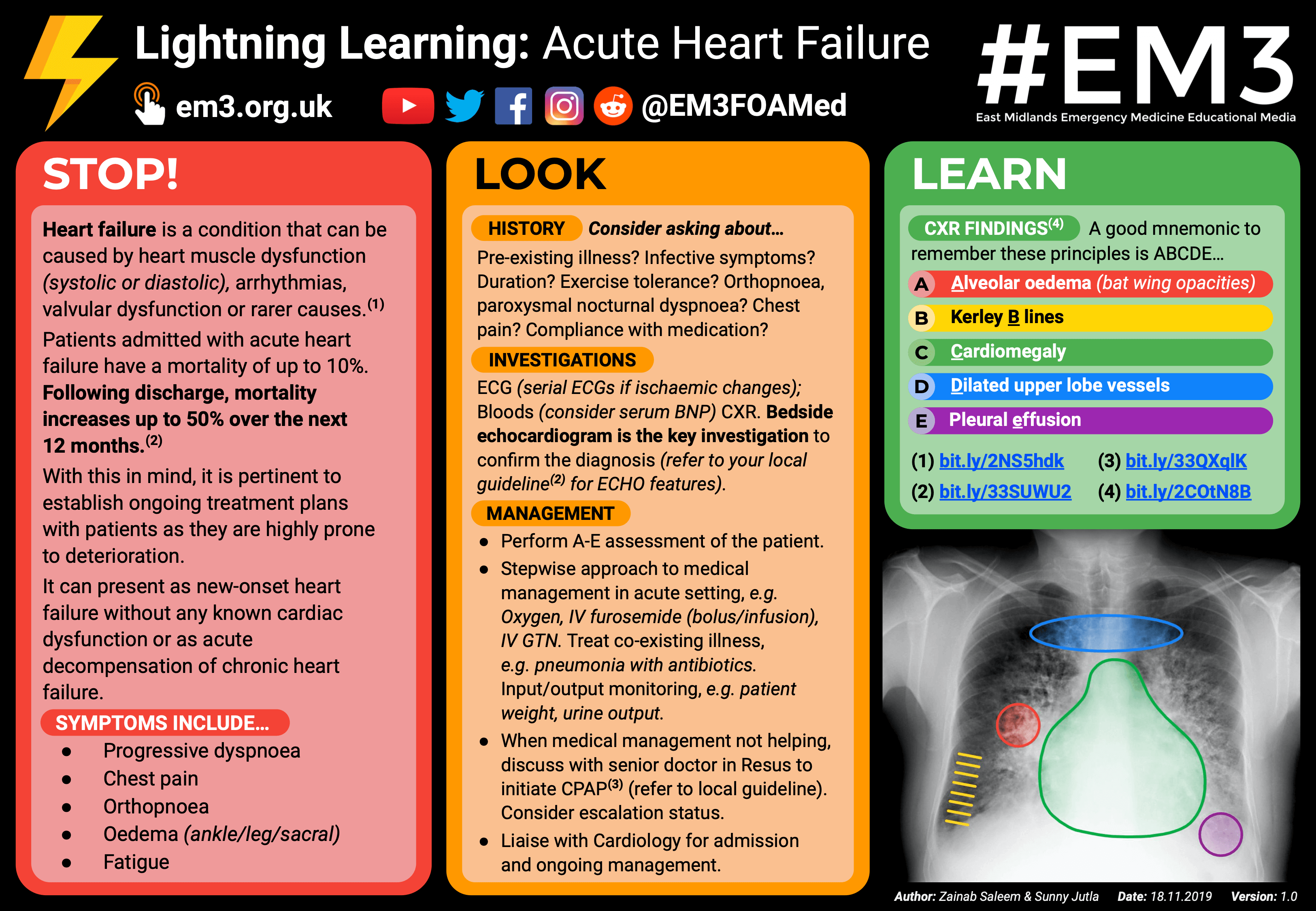 Acute Heart Failure (POSTER) r/medicine