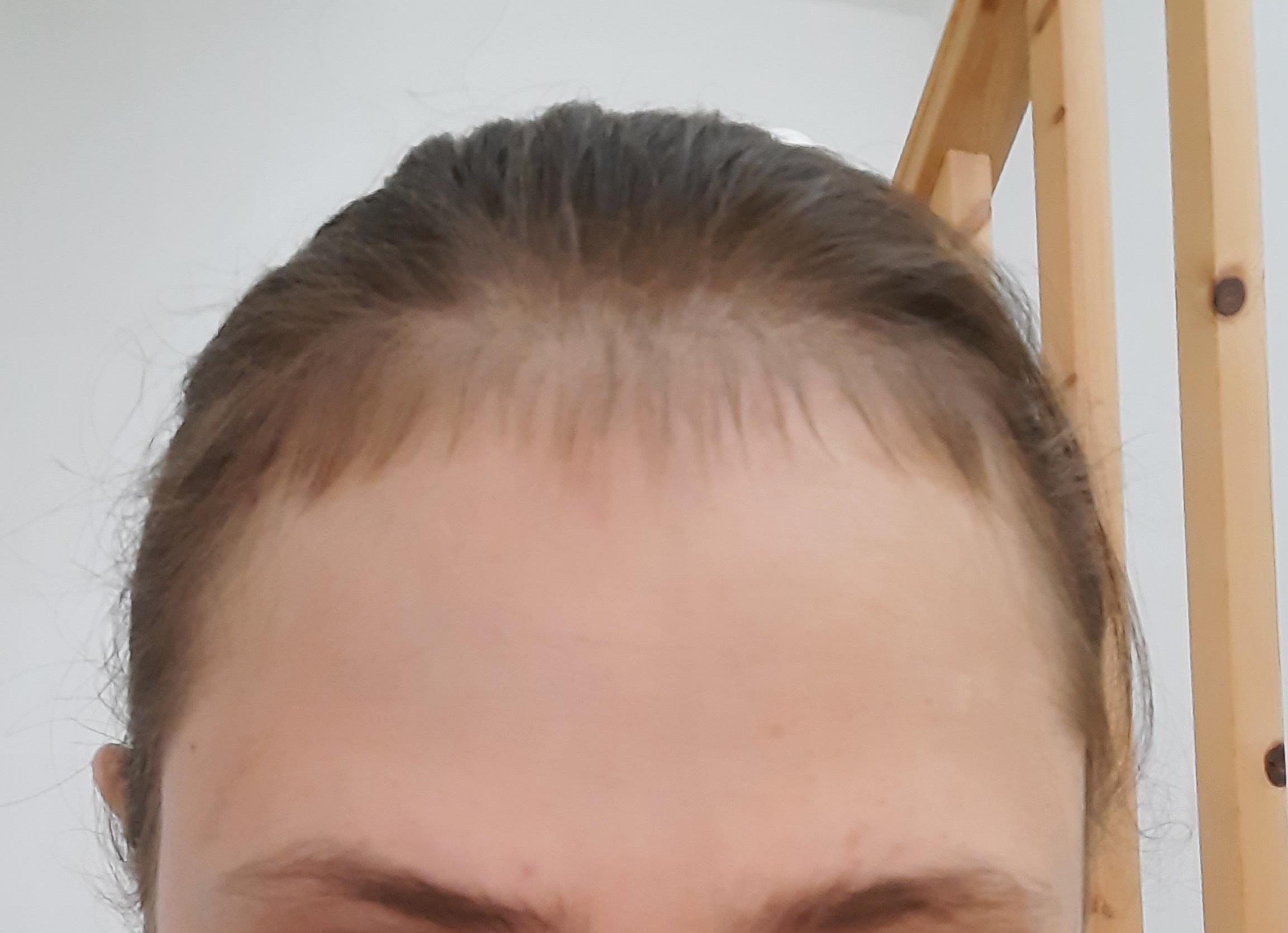 819 best Postpartum images on Pholder Progresspics