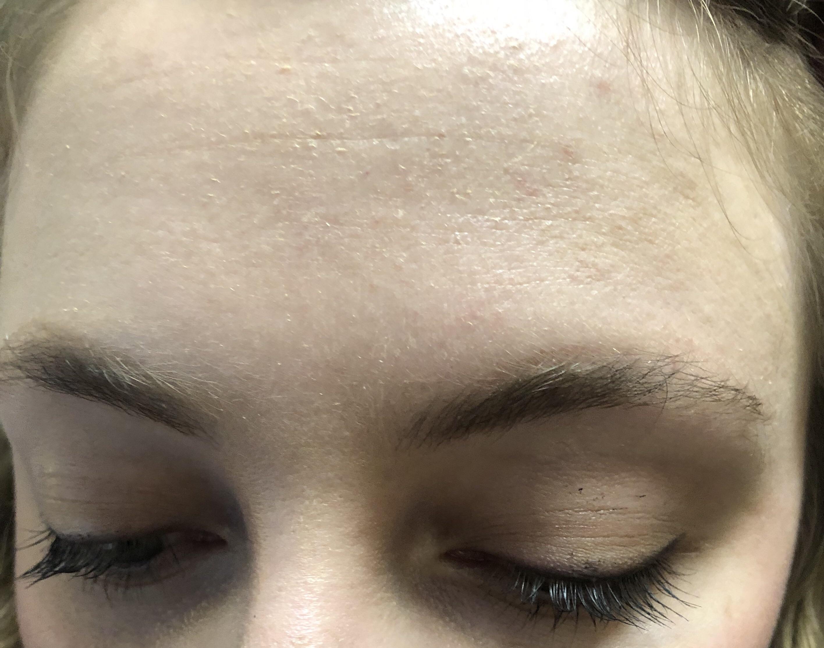 [Skin Concerns] My forehead keeps getting patchy and I’m out of ideas
