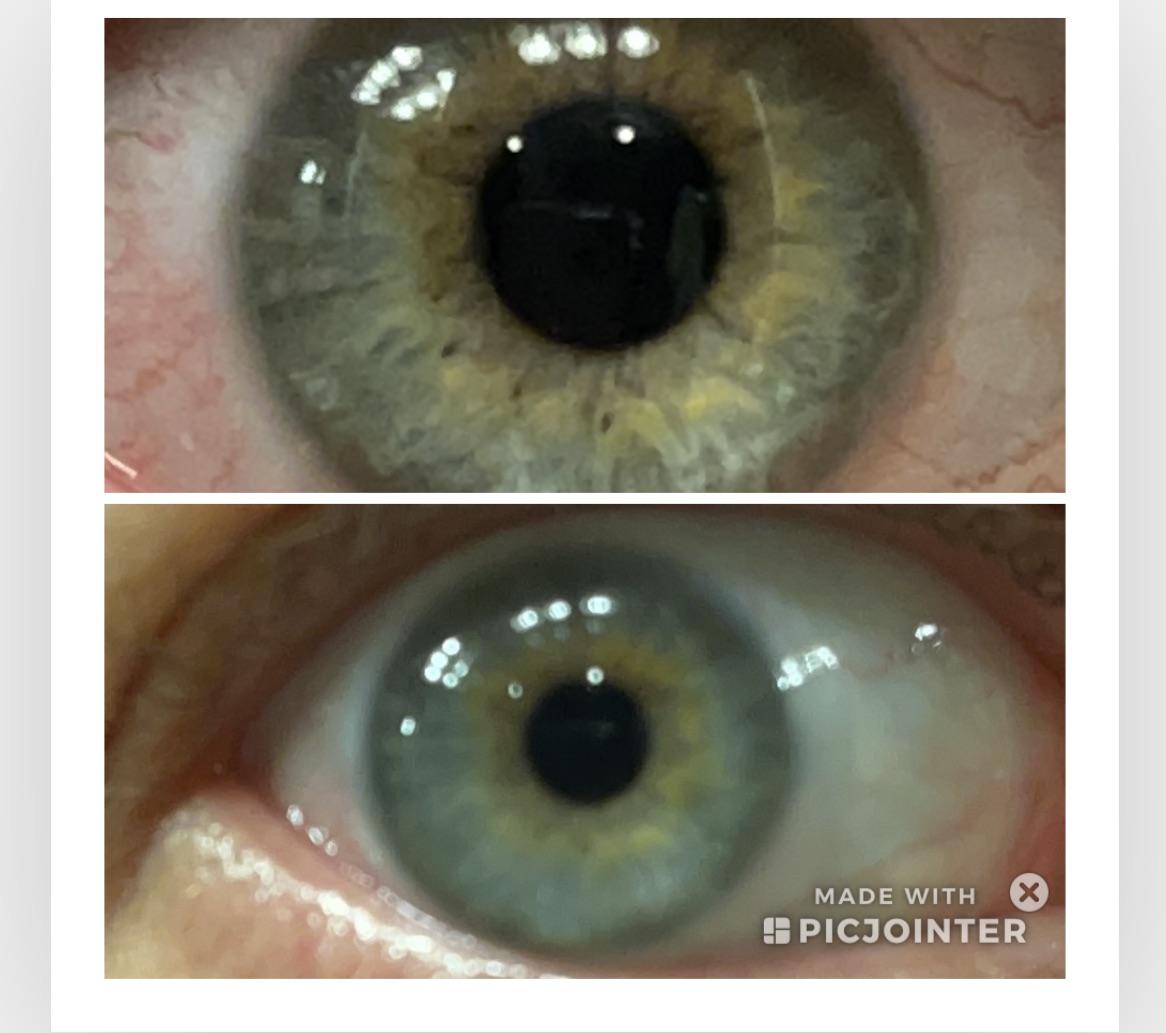 Loving the eye analysis! I can’t even tell what color my eyes are