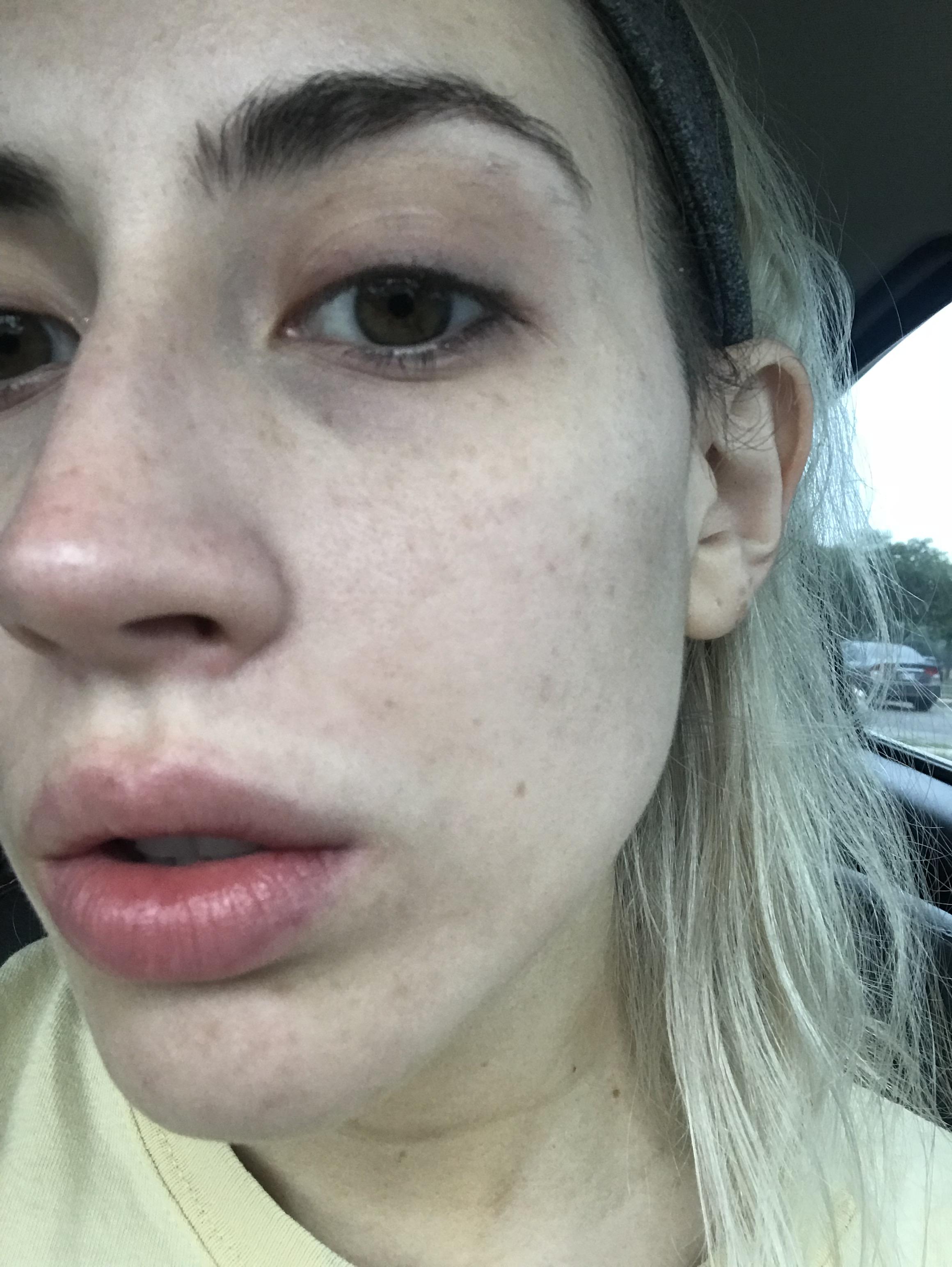 [Skin Concerns] What is the deal with my skin? It’s so blotchy all the