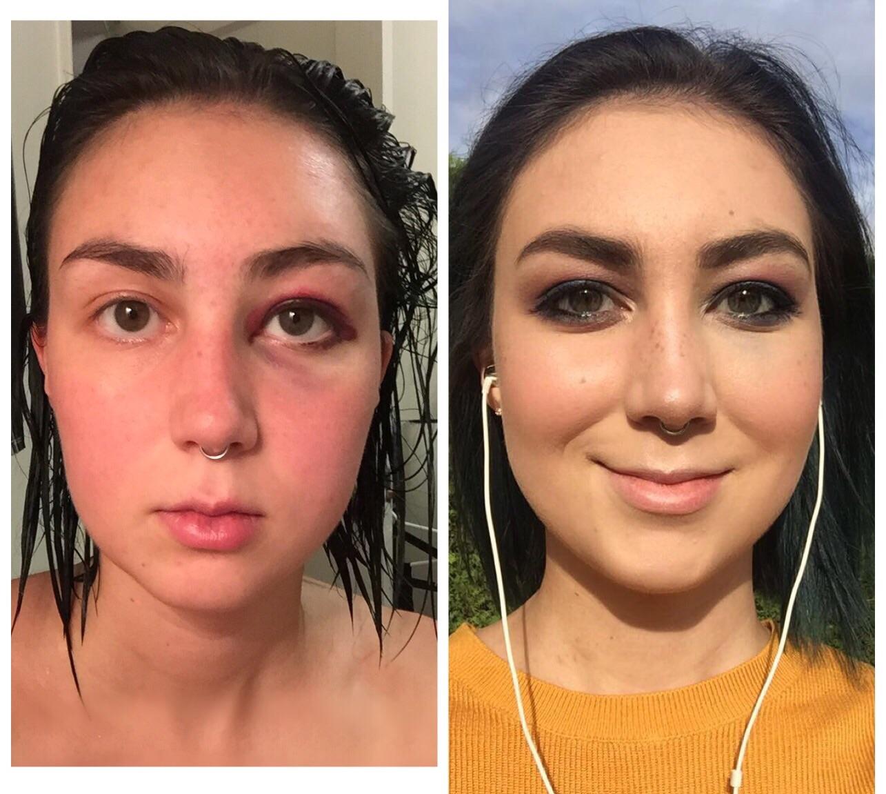 Makeup To Cover A Black Eye