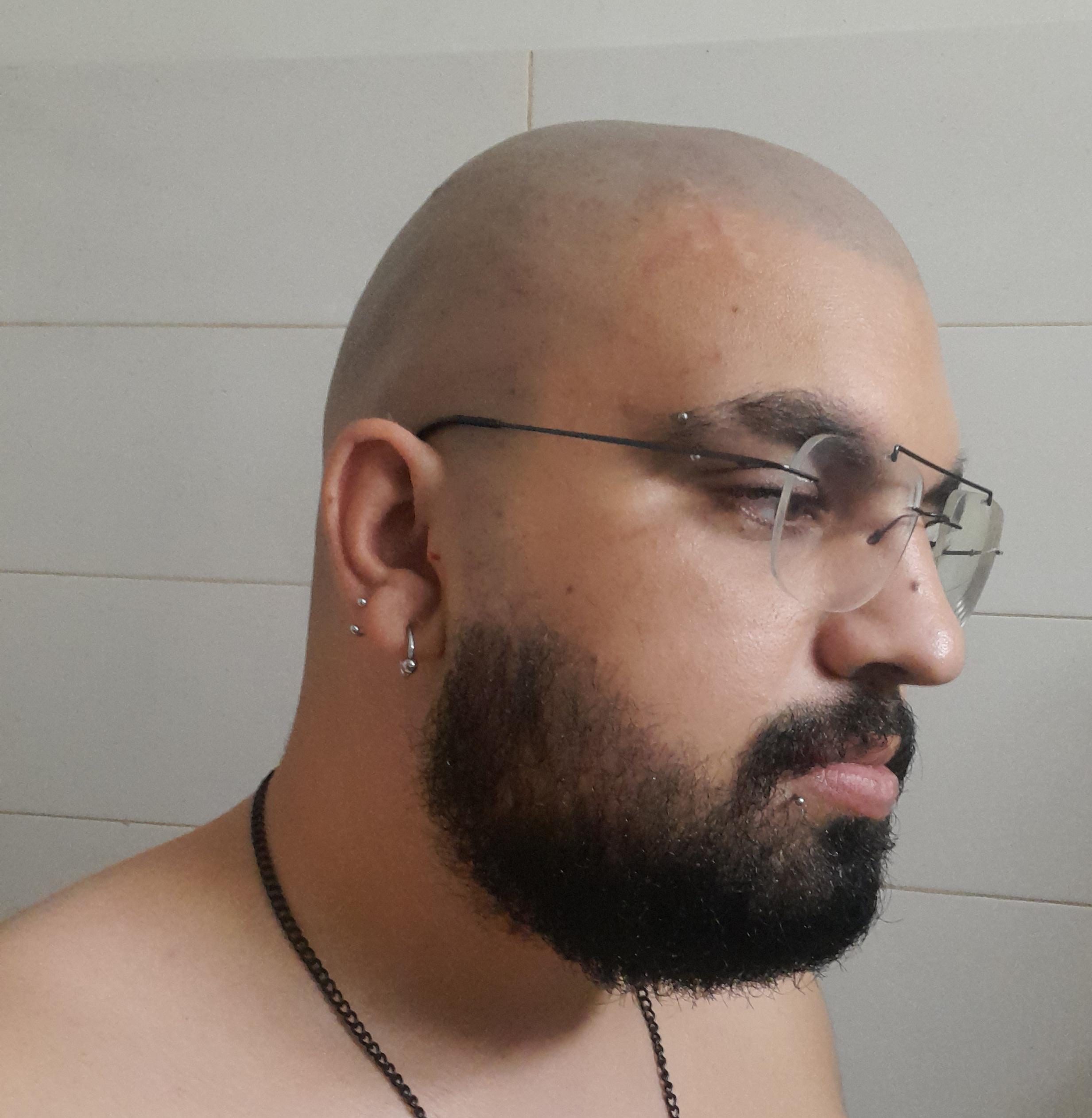 HELP I AM DEVASTED!!! I accidentally shaved off too much of my