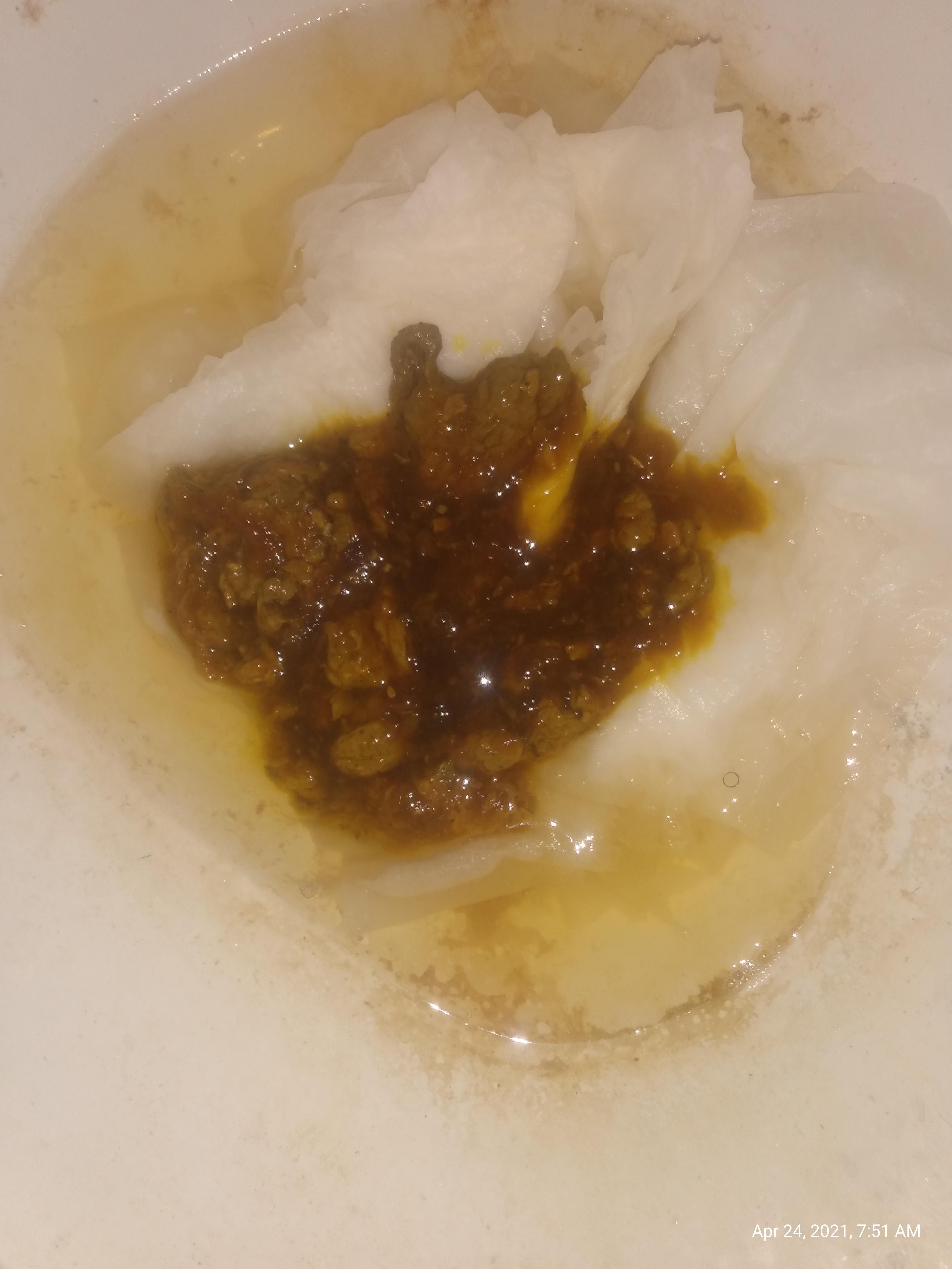 Does this look like blood in my stool? For those who have had it? r