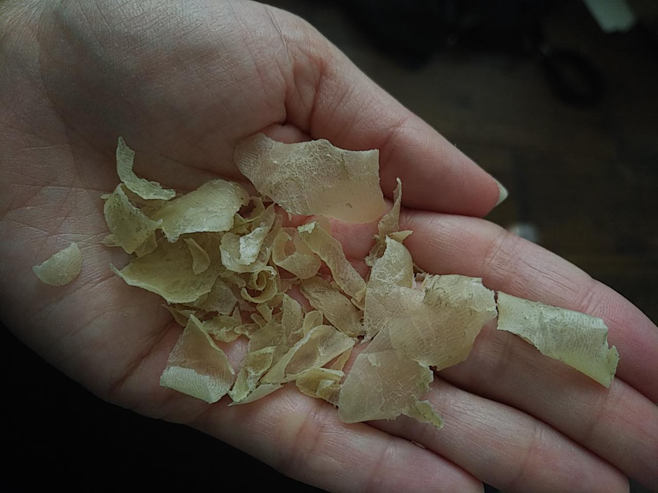 Went on a long walk, and all the dead skin on my heel decided it could