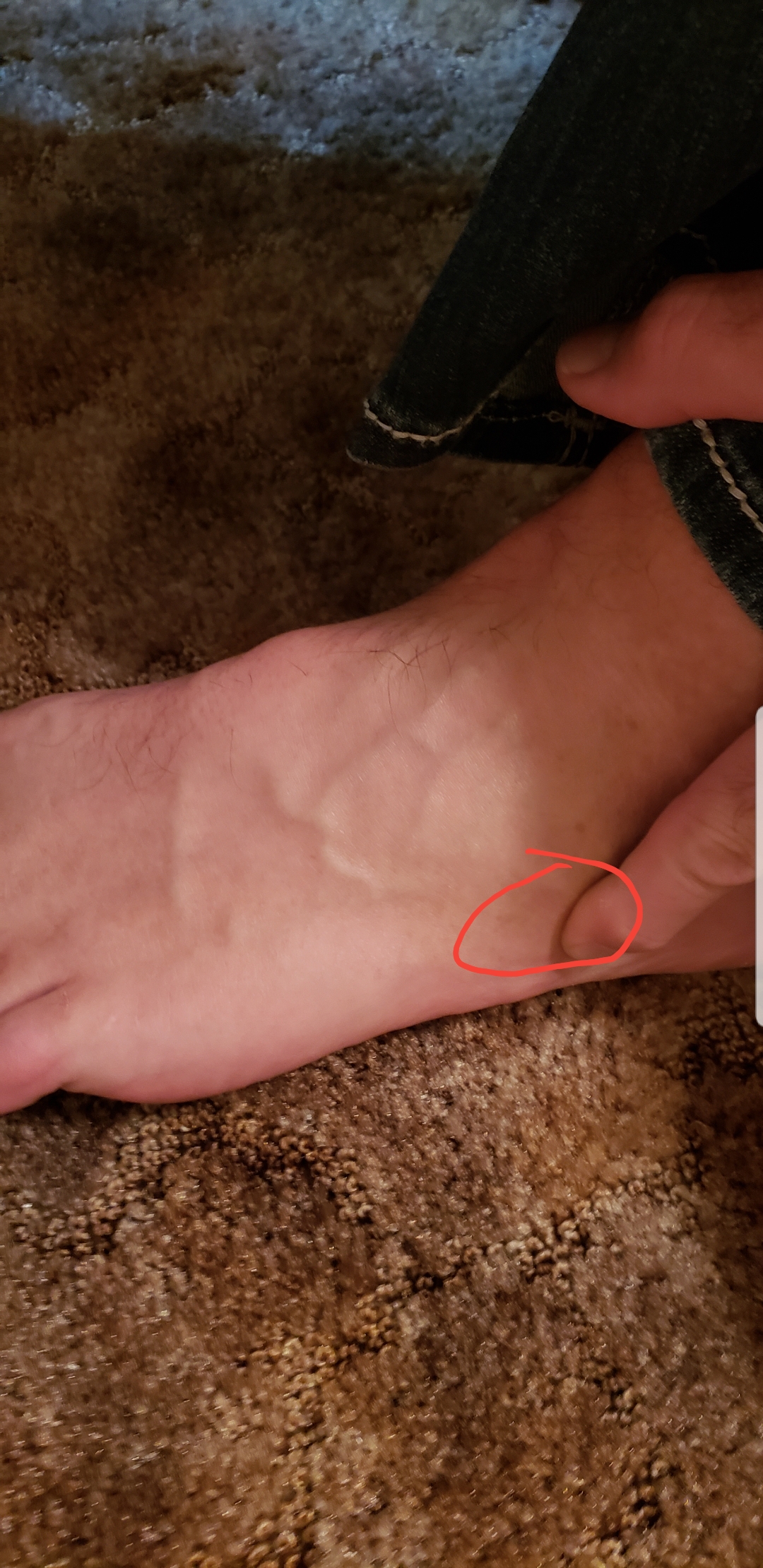 Foot pain, sensitive to touch at this point trailrunning
