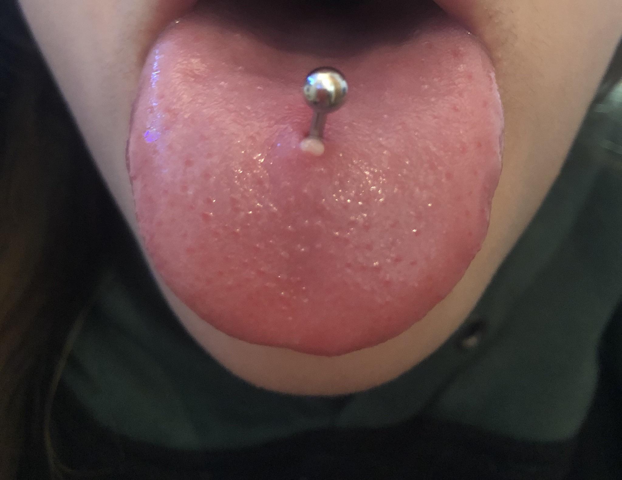 I’m not sure if my tongue piercing is infected but I just got it
