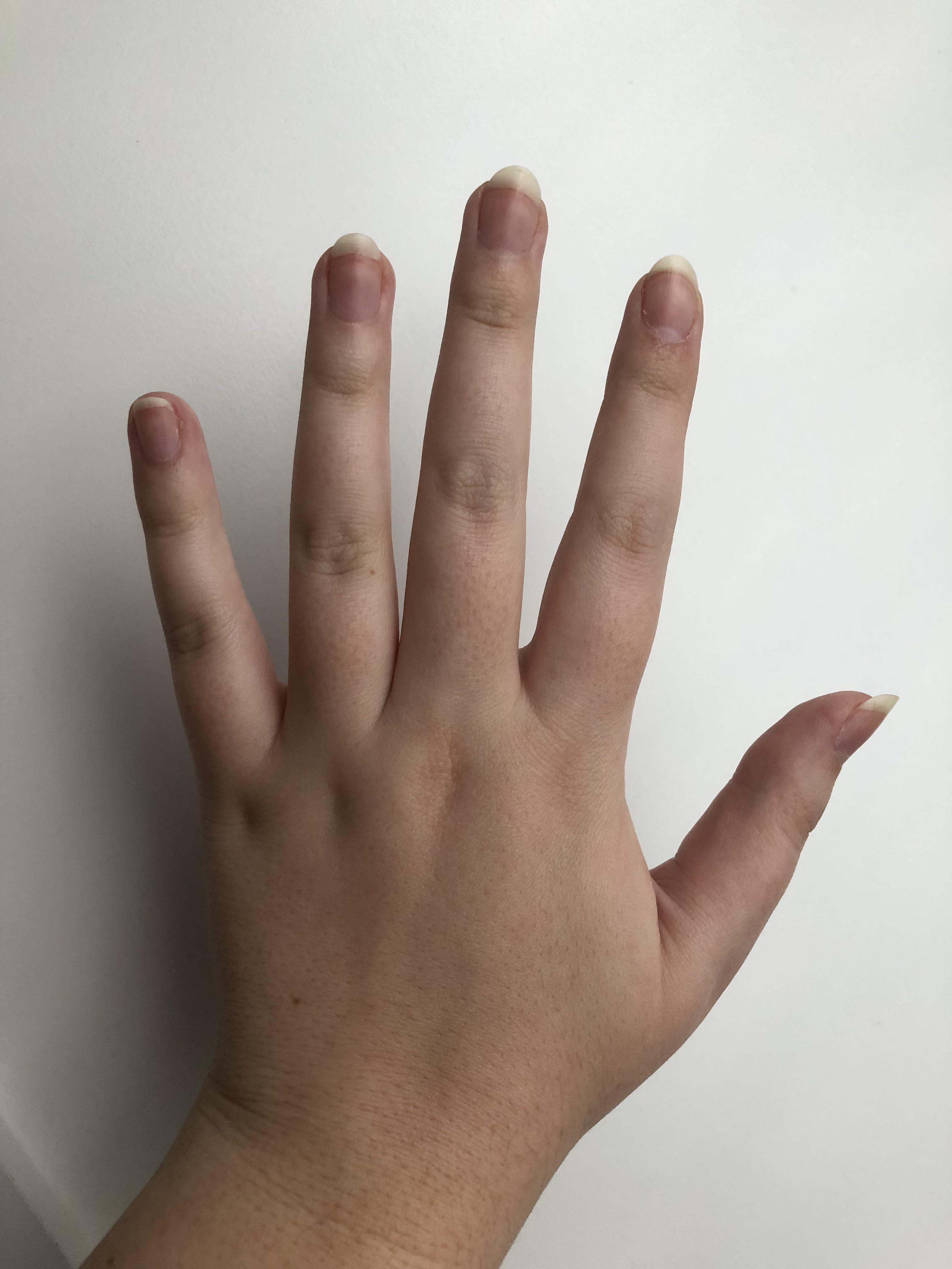 How to whiten natural nails? r/beauty