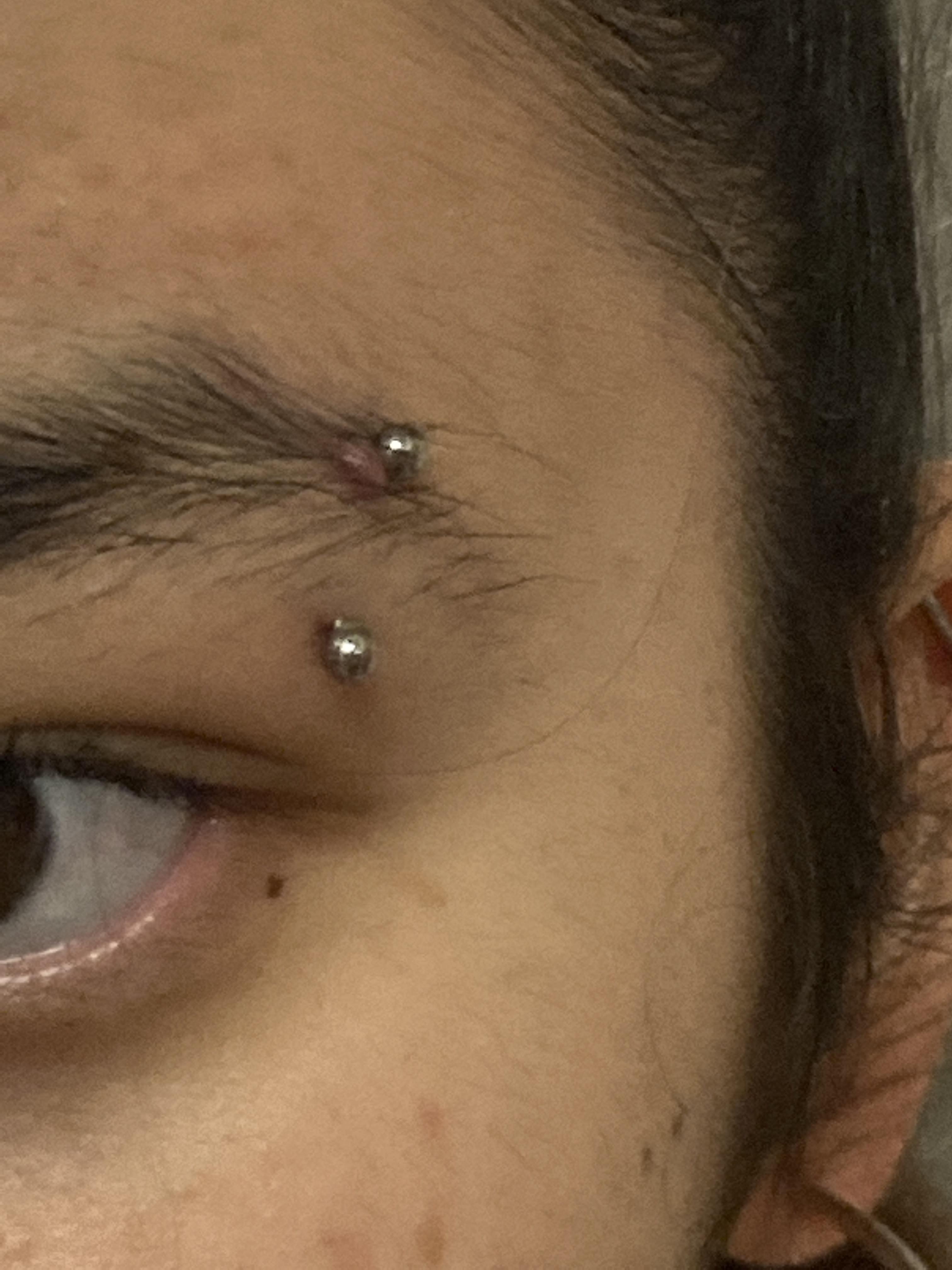 Eyebrow piercing keloid? I got my piercing 6 months ago and it was fine
