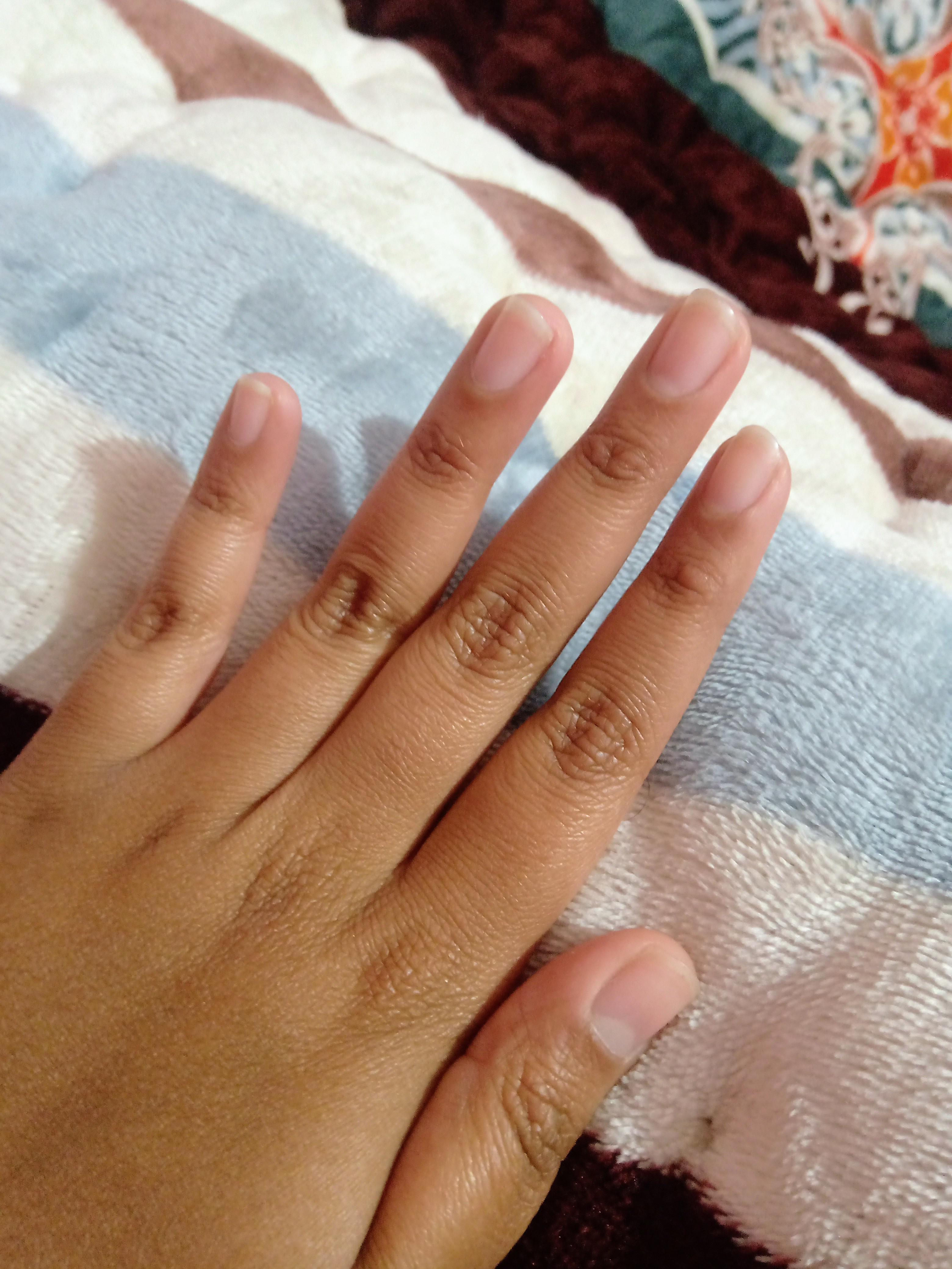 These are my natural nails. They're the length I usually like but for some reason my thumb's