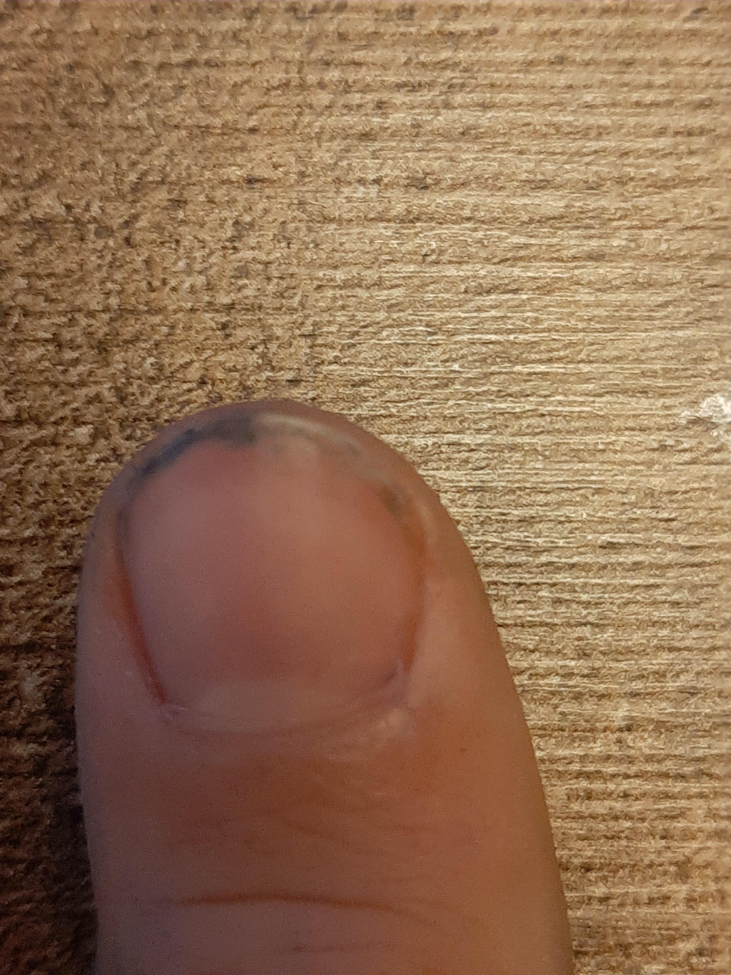 Thanks i hate paper cuts ( paper cut under my nail) r/TIHI