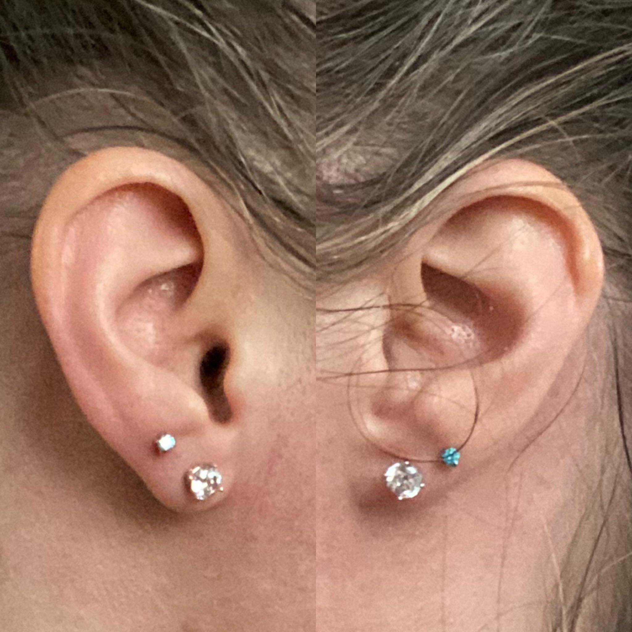 Uneven lobes would you get them redone a second time? Story in
