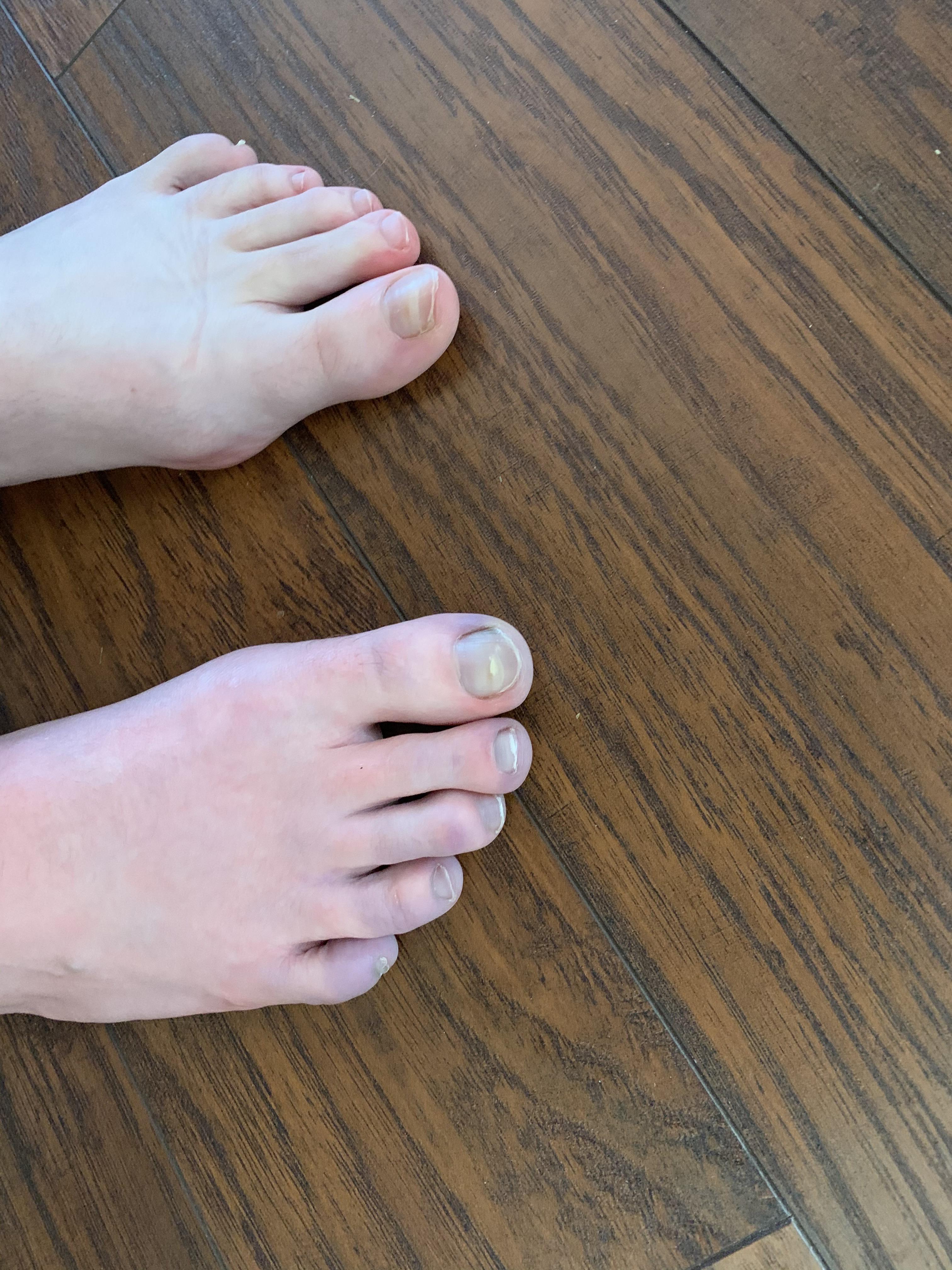 While sitting today on my left footmy right foot started to go numb r/medical_advice