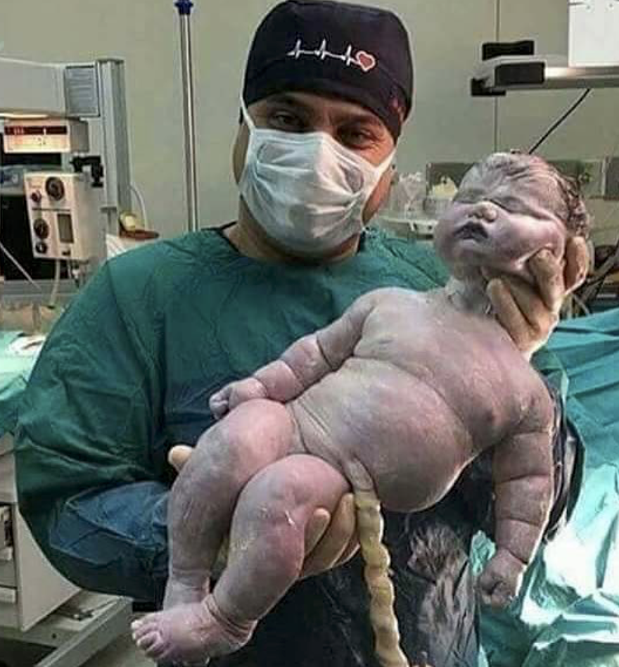 The biggest baby born by natural birth, weighing roughly