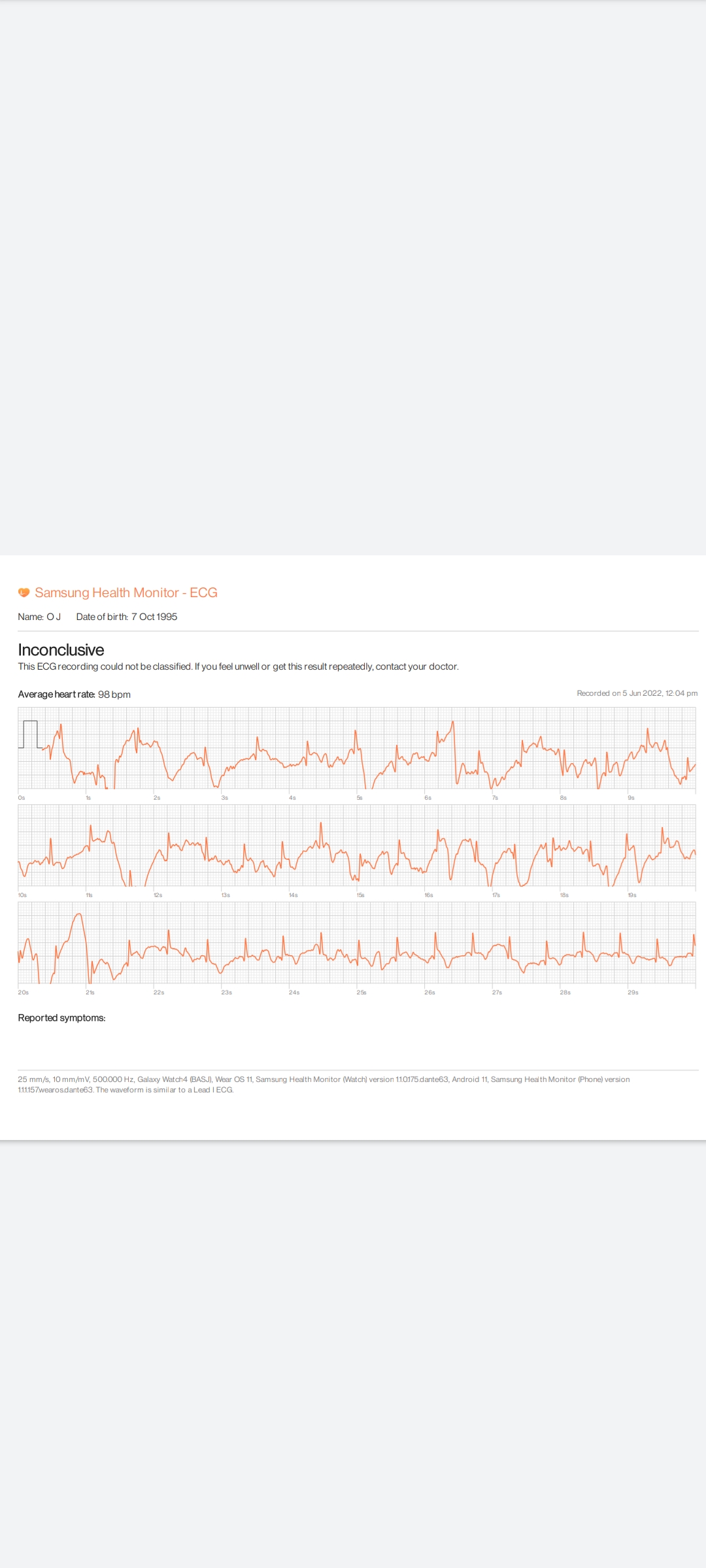 Chest pain and shortness of breath when walking fast. Had numerous