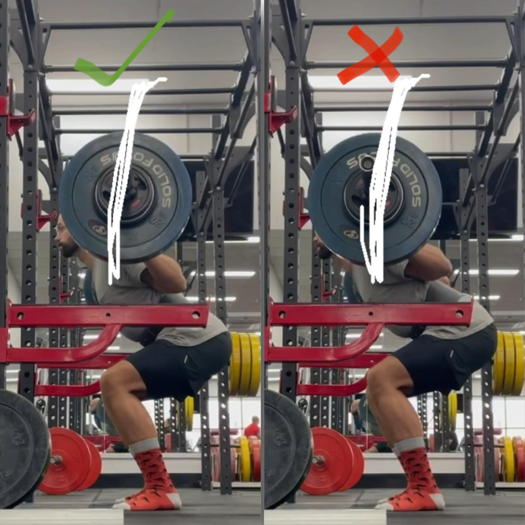 Sprained my low back today on fourth rep of 150lb back squat, left is