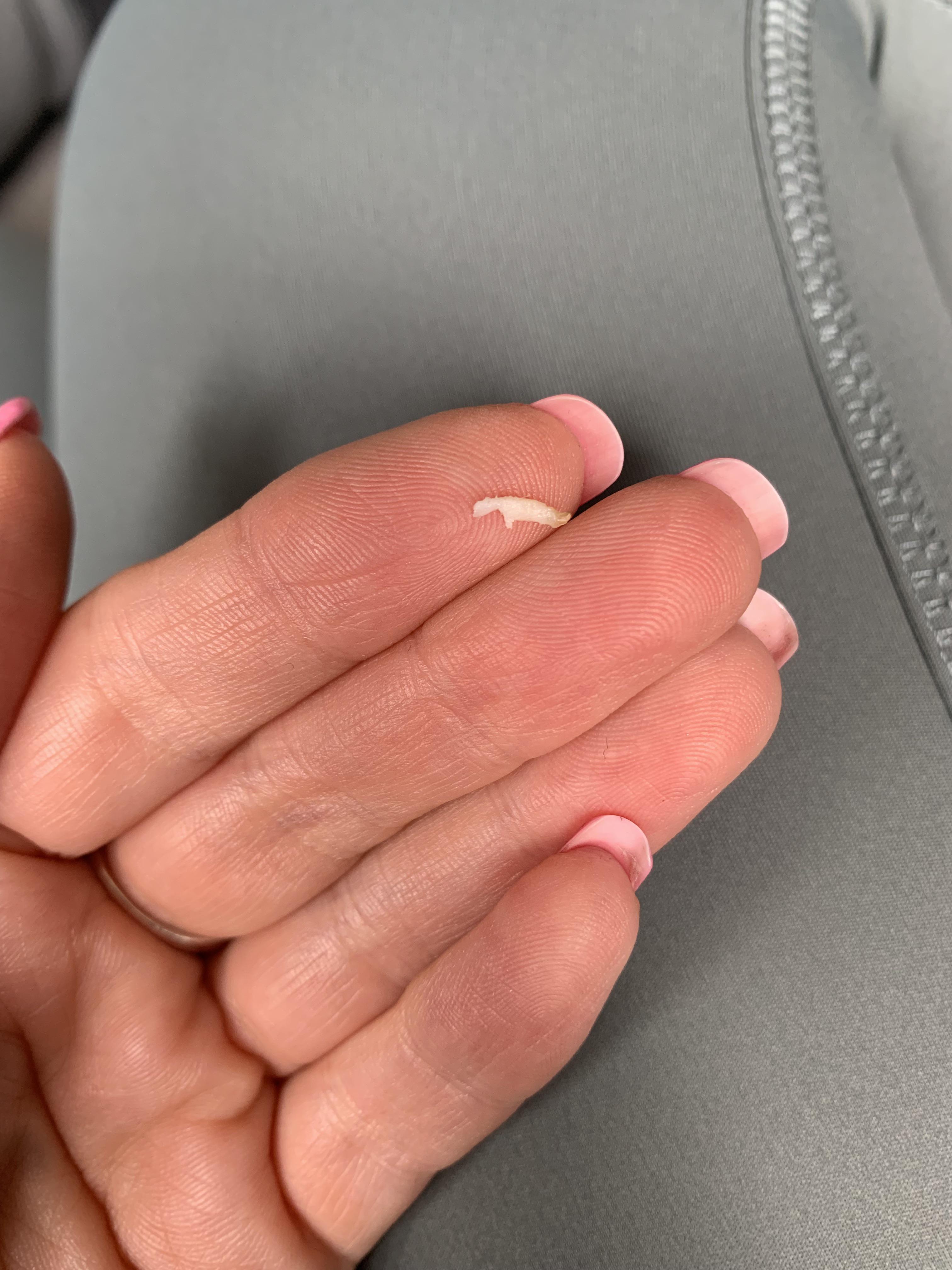 Naval piercing gunk trying to put my belly bar back in after removing