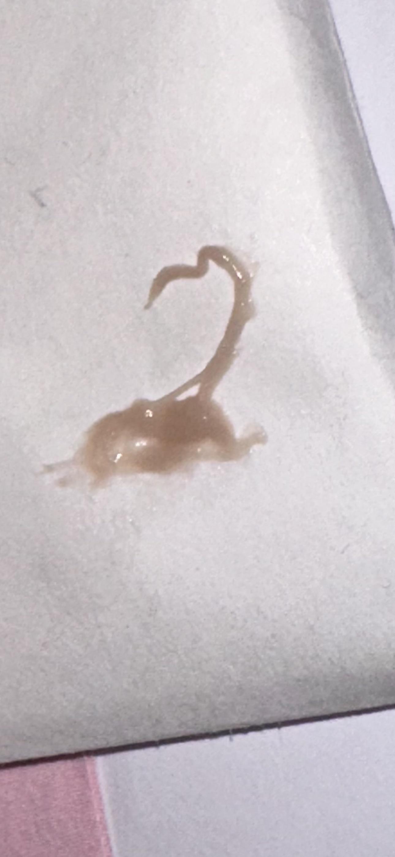 On semaglutide. Late for period, only getting brown mucus discharge r