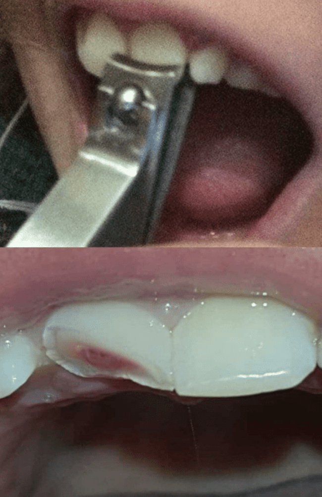 Thanks I hate, and I mean HATE cutting teeth with Clippers. r/TIHI