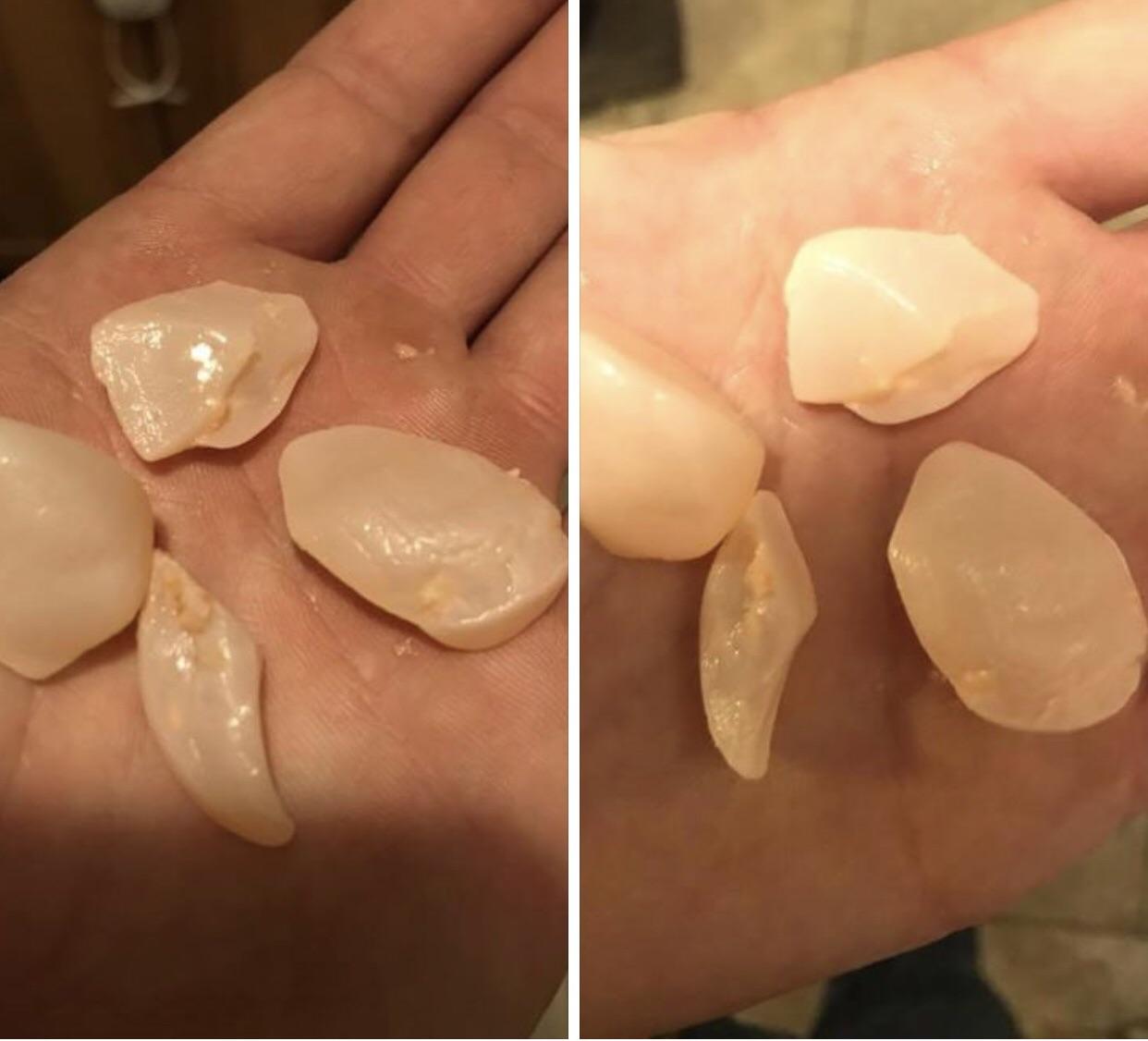 What did this toddler throw up?! 15 months old, ER dr had no idea. Not