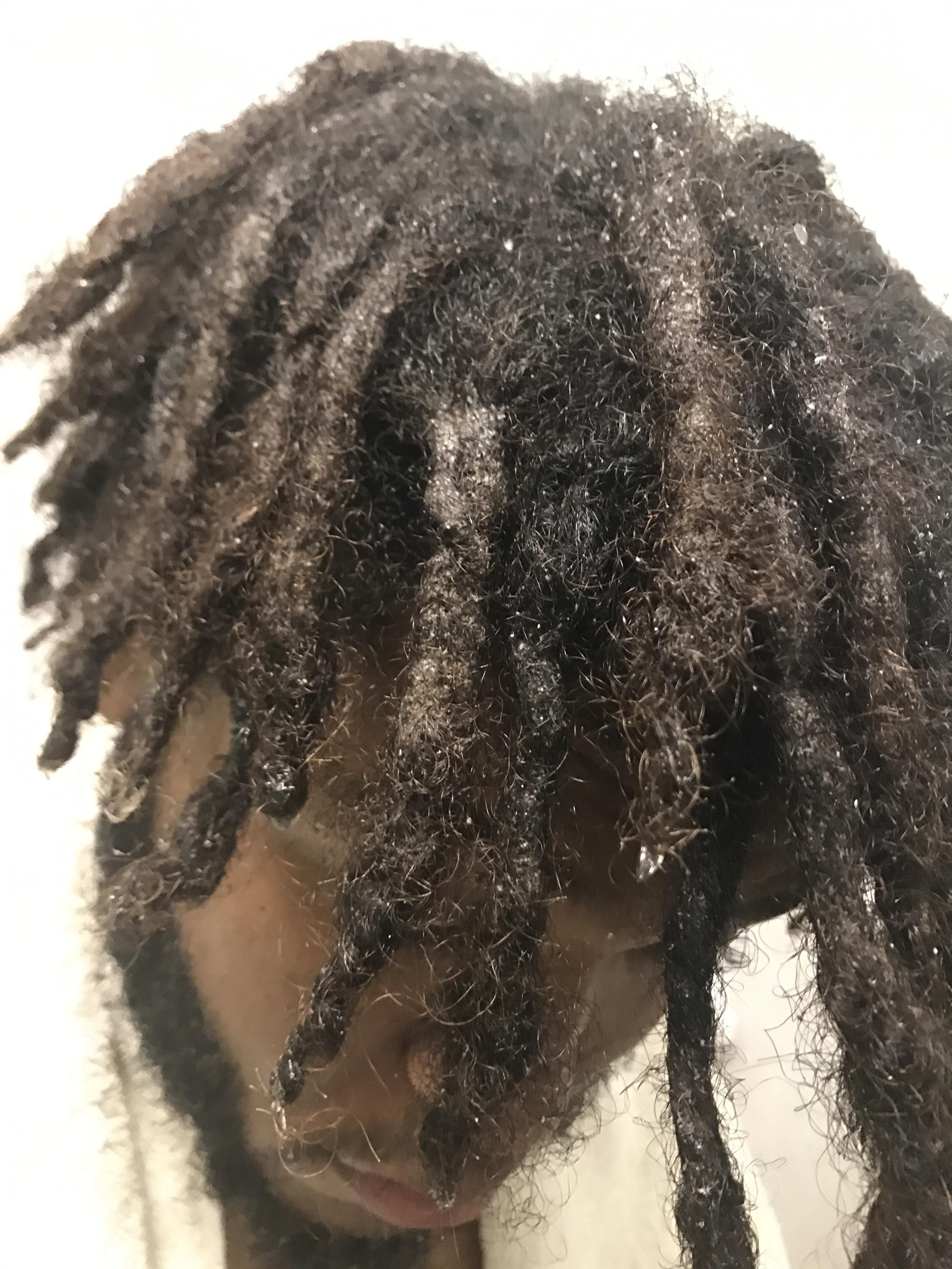 !HELP! What is this white stuff/discoloration in my dreads? r/Dreadlocks