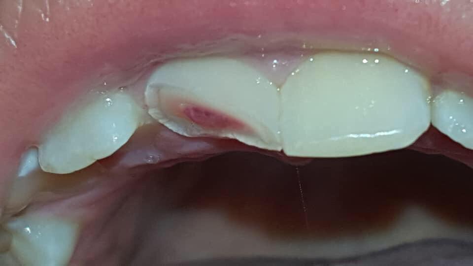 Teeth r/MakeMeSuffer