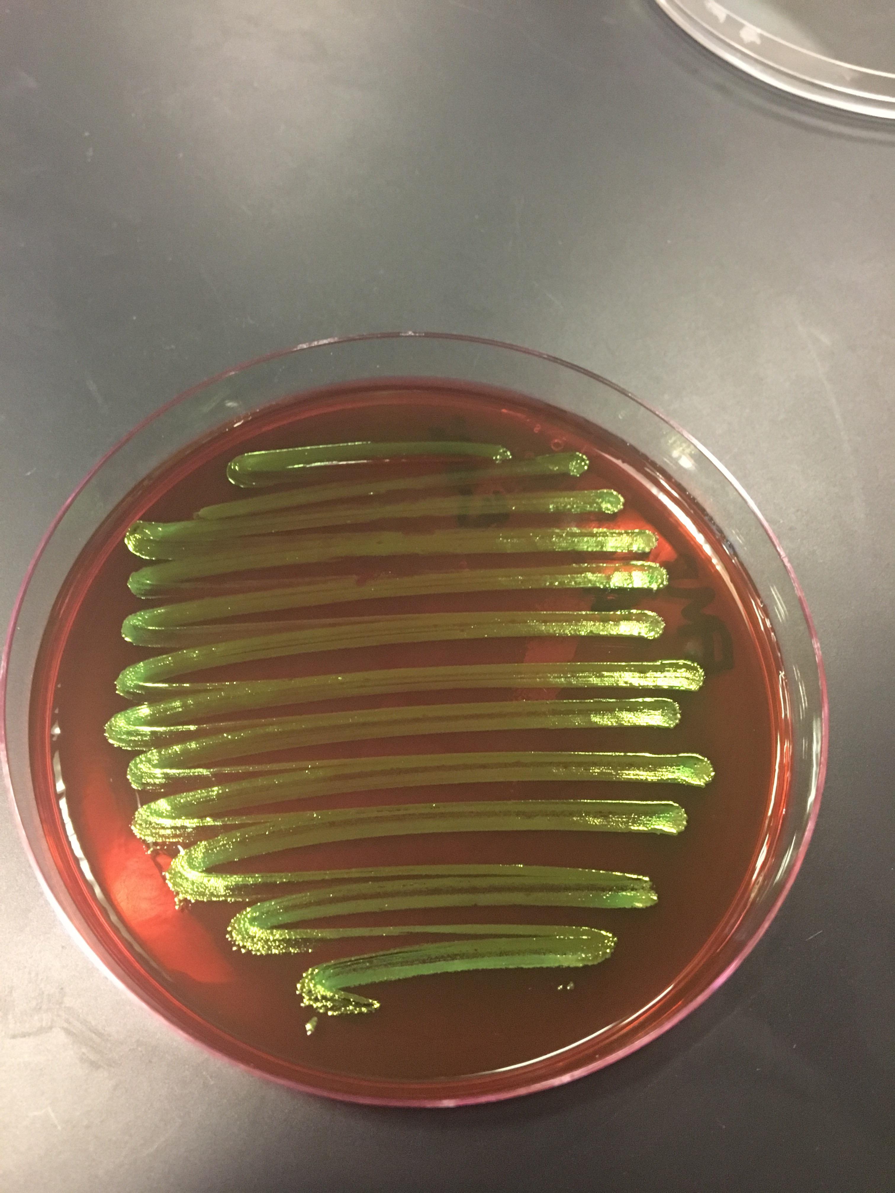 This streak of E.coli on an EMB plate r/oddlysatisfying