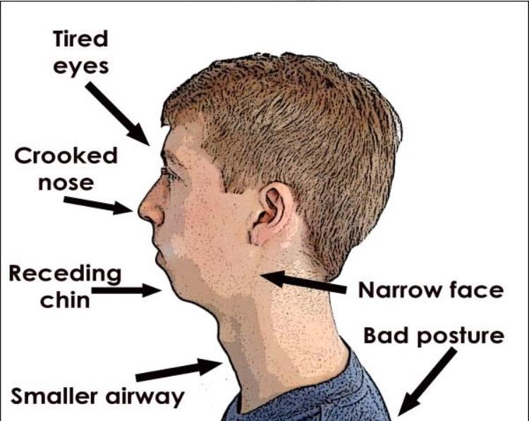 JaggedEclair (u/JaggedEclair) Reddit