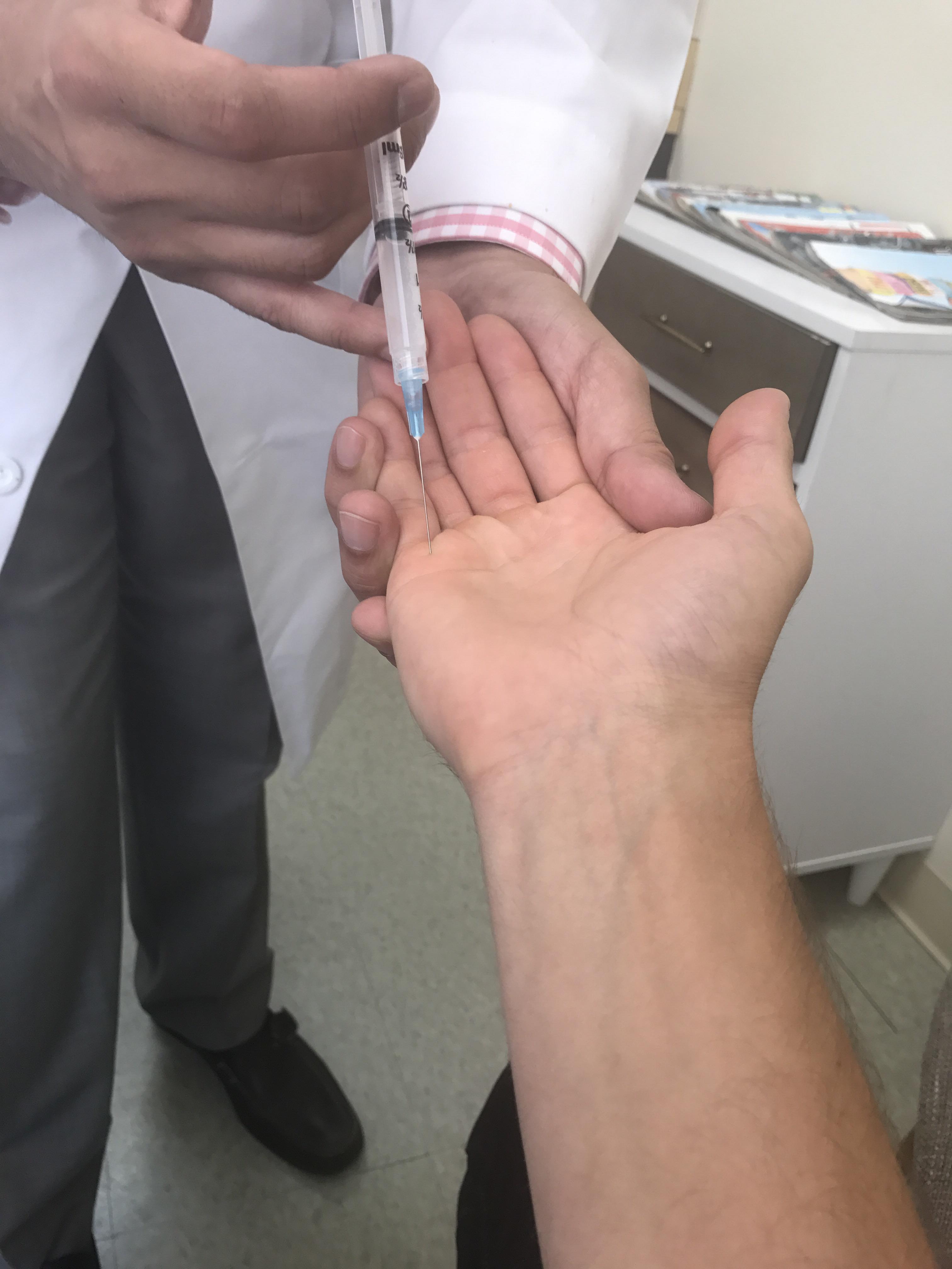 Too much golf too quick = trigger finger r/golf