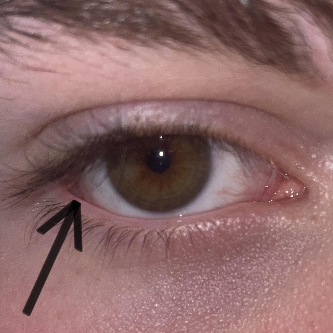 I just realized not everyone has a gap in the corner of their eye