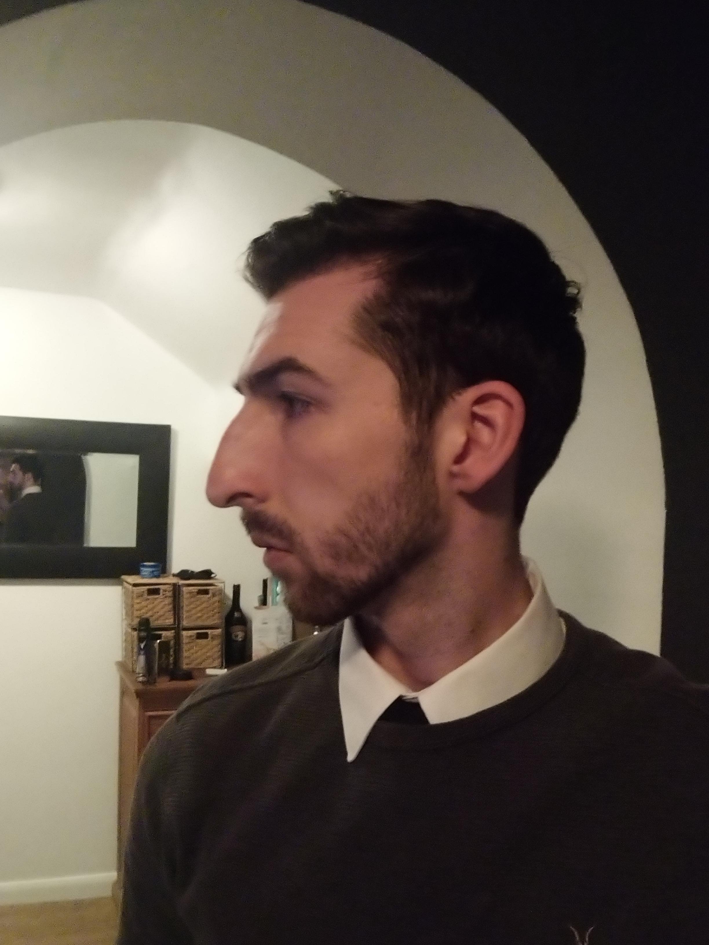 Receeding hairline. Want to shave but worried it won't suit due to my