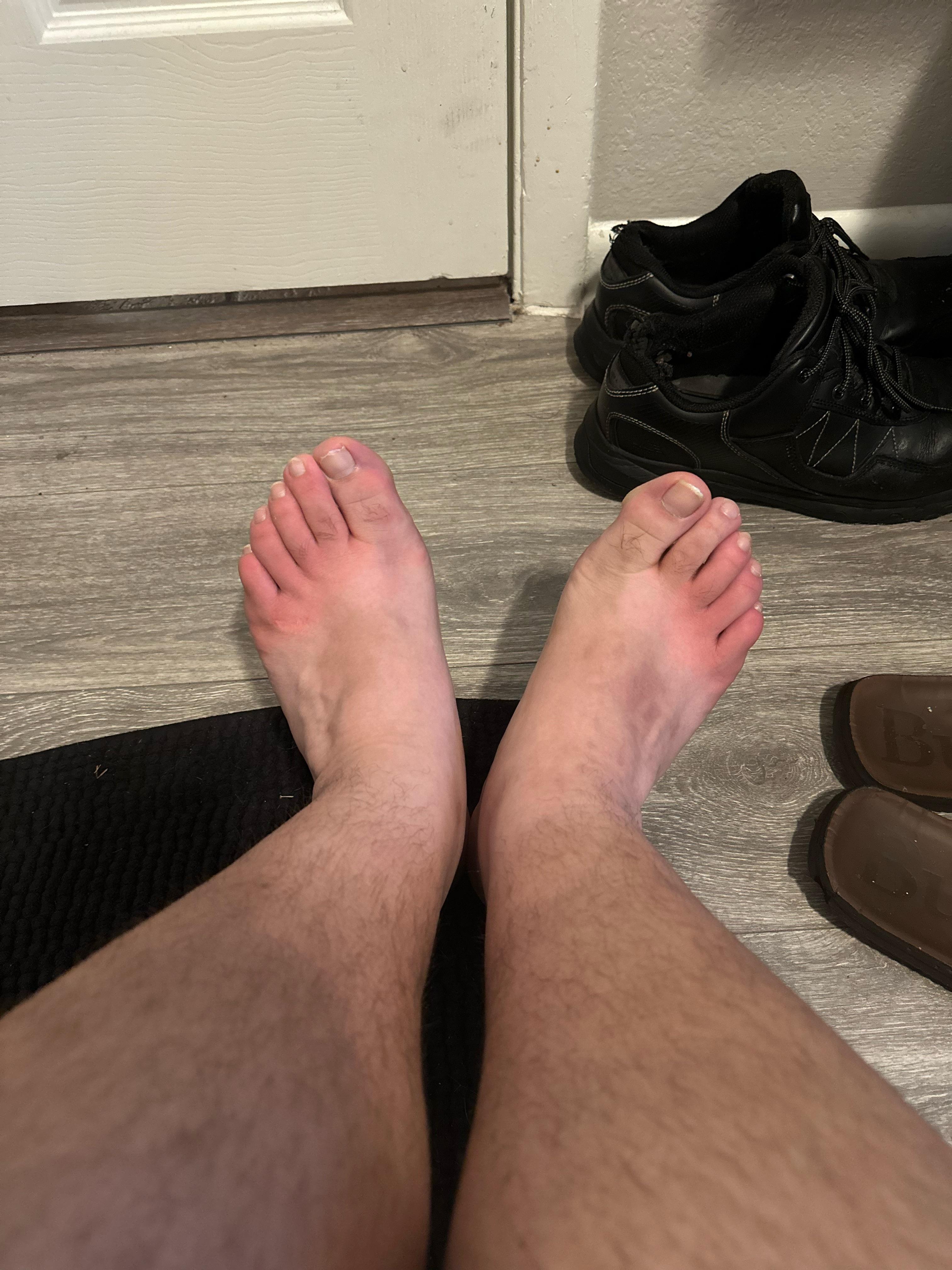 Does anyone know what I got going on here could it be athletes foot but